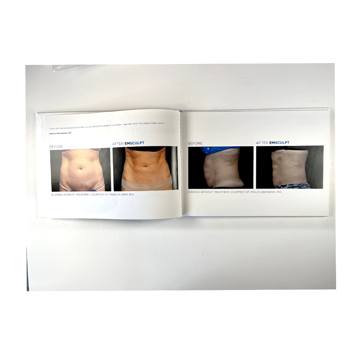 BTL EMsculpt Build Muscle & Sculpt Your Body Lift Buttock Non-Invasively 799-77EMCBABENUS102 btl-1