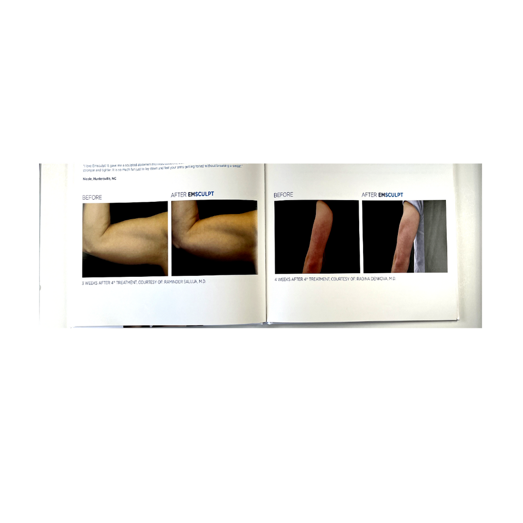 BTL EMsculpt Build Muscle & Sculpt Your Body Lift Buttock Non-Invasively 799-77EMCBABENUS102 btl-1
