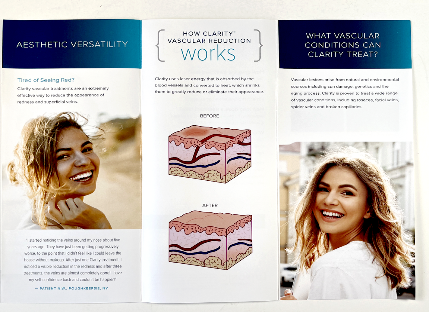 Redness & ven Reduction ASK FOR CLARITY Multi-pupose Laser Brochure 50 pcs
