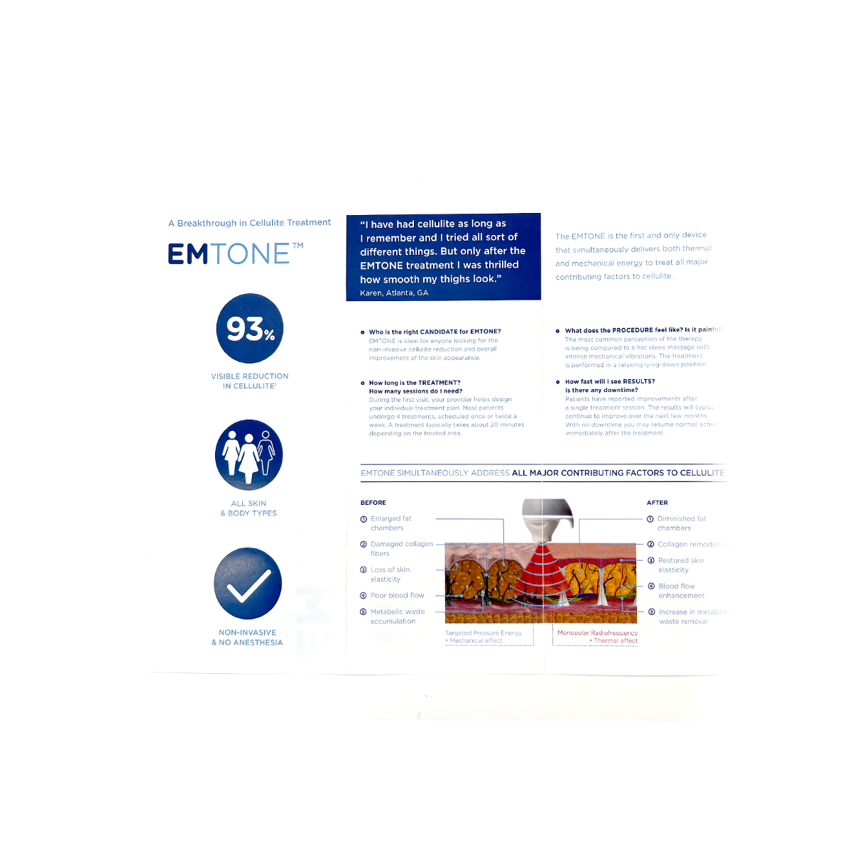 Toned. Not Textured Non-Invasive - No Downtime EMTONE Brochure "100 pack"
