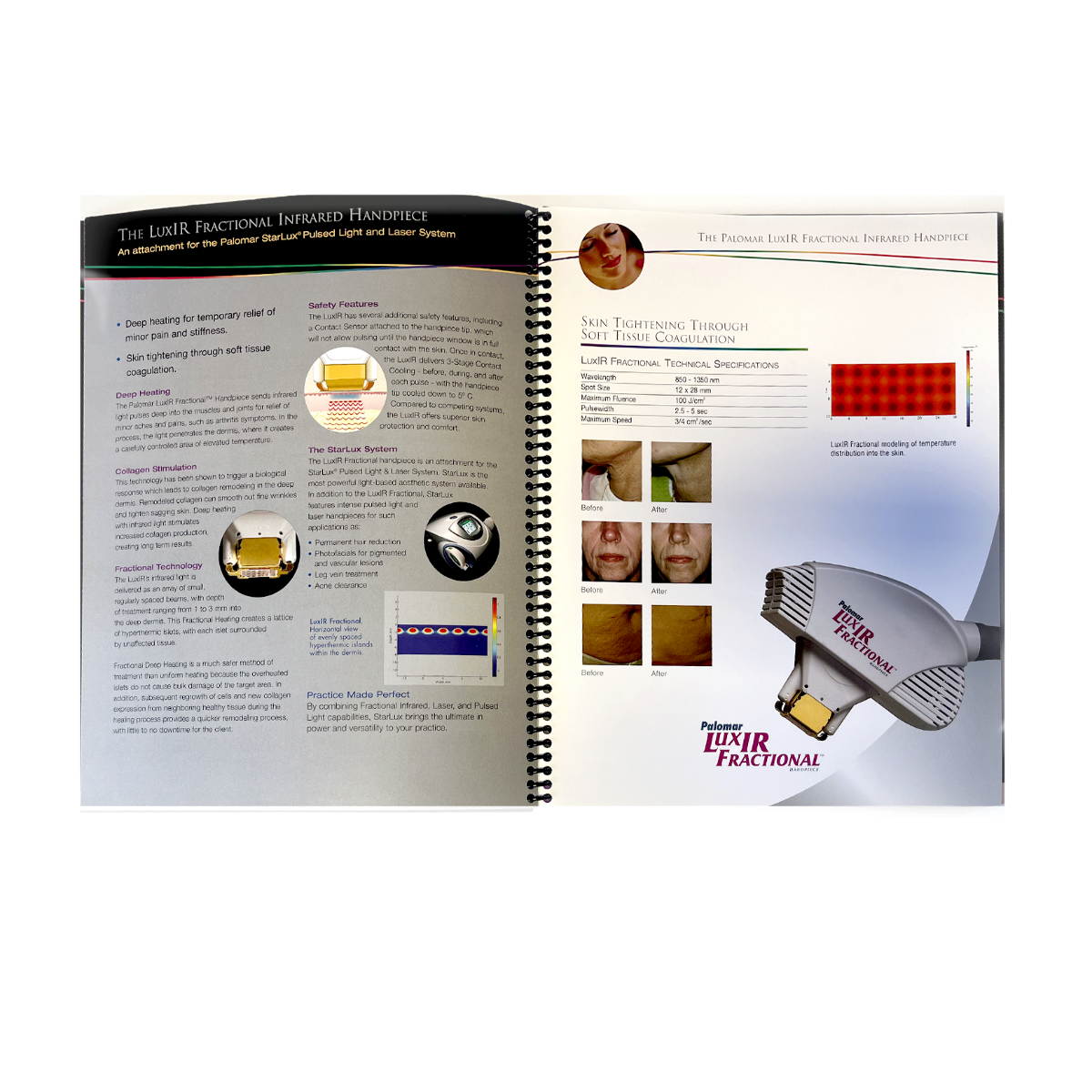 Palomar StarLux Pulsed Light and Laser System Informational Manual