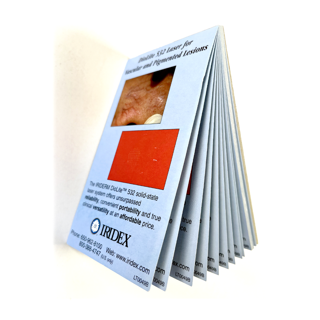 IRIDEX Diolite 532 Laser for Vascular And Pigmented Lesions LT0049B