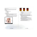 Cutera Prowave LX Treatment Guidelines 2015 D1471 Rev.D