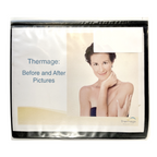 Thermage: Before and After Picture, treatment Guide