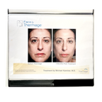 Thermage: Before and After Picture, treatment Guide