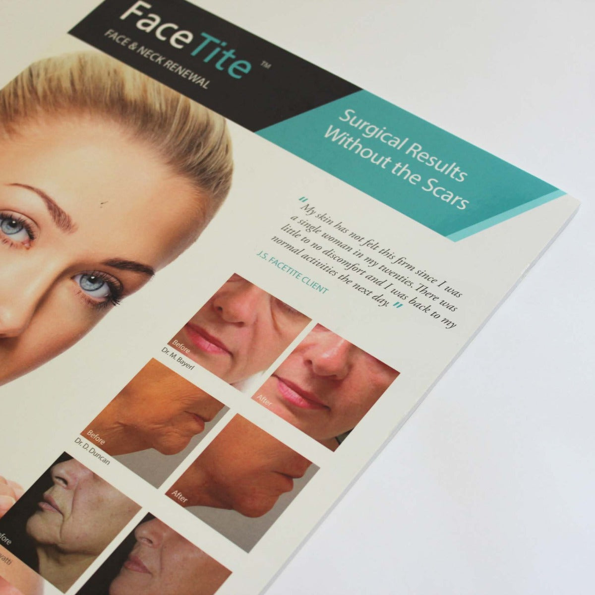 InMode FaceTite Wrinkles Face & Neck Rejuvenation Marketing Poster 11x17"