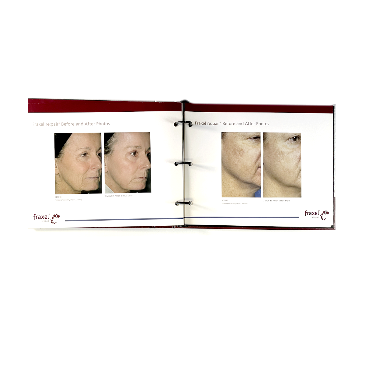 FRAXEL, “Repairing Your Aged and Damaged Skin” Booklet