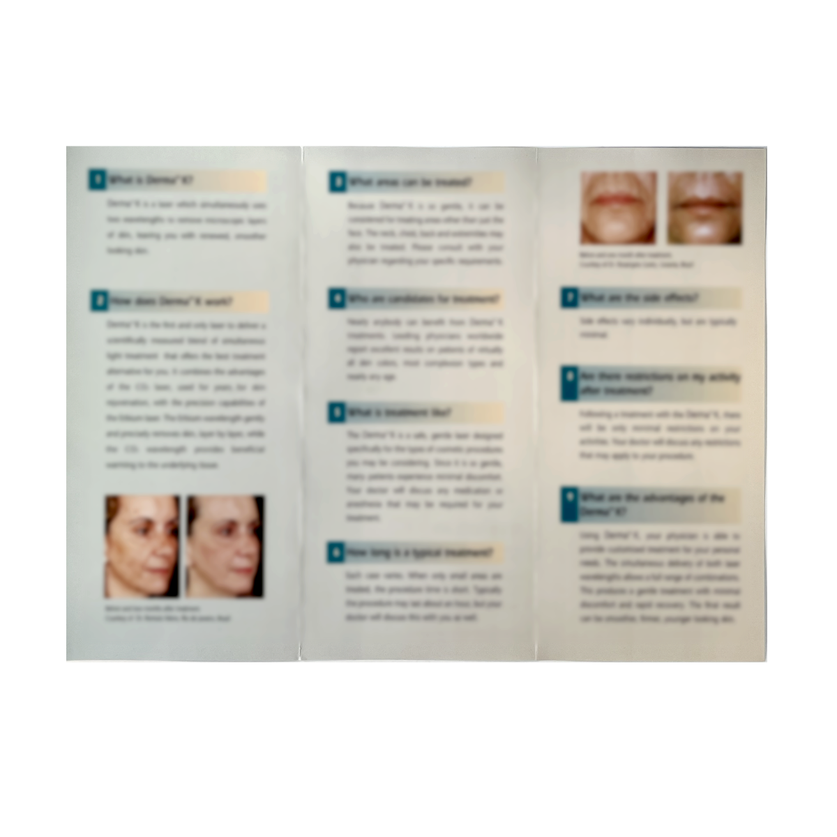 ESC Medical, Rejuvenate your appearance with Derma K, “The most advanced skin rejuvenation laser” Brochure, P/N: PB 708-0010 Rev.B, 1998 (50 Pack)