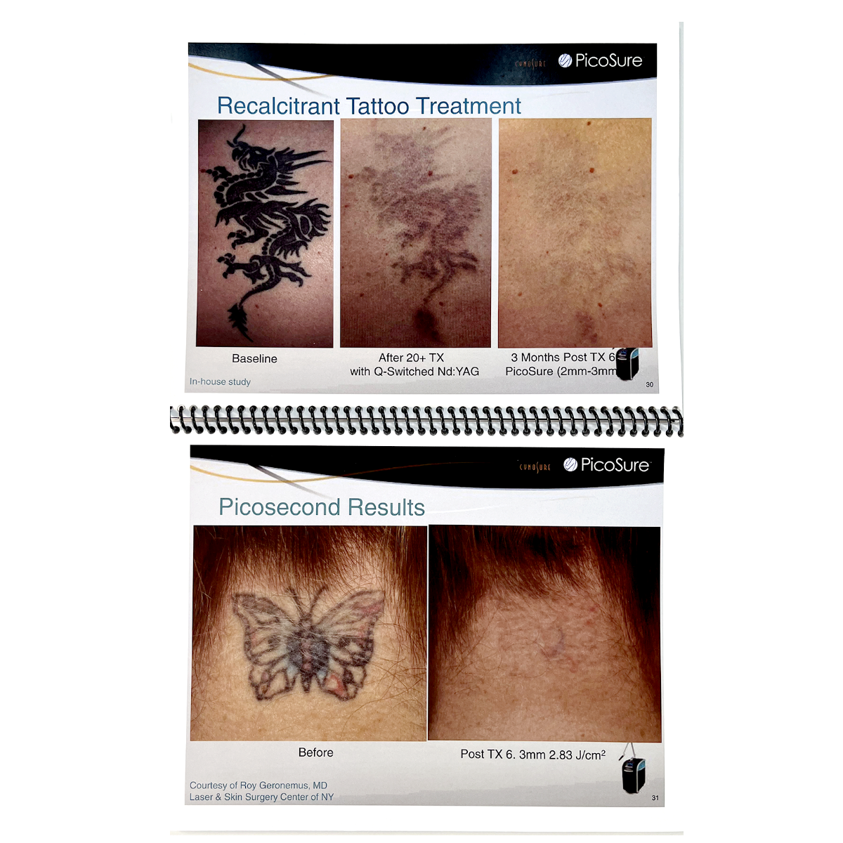CYNOSURE, PicoSure Changing dermatology Forever, Clinical Training Presentation