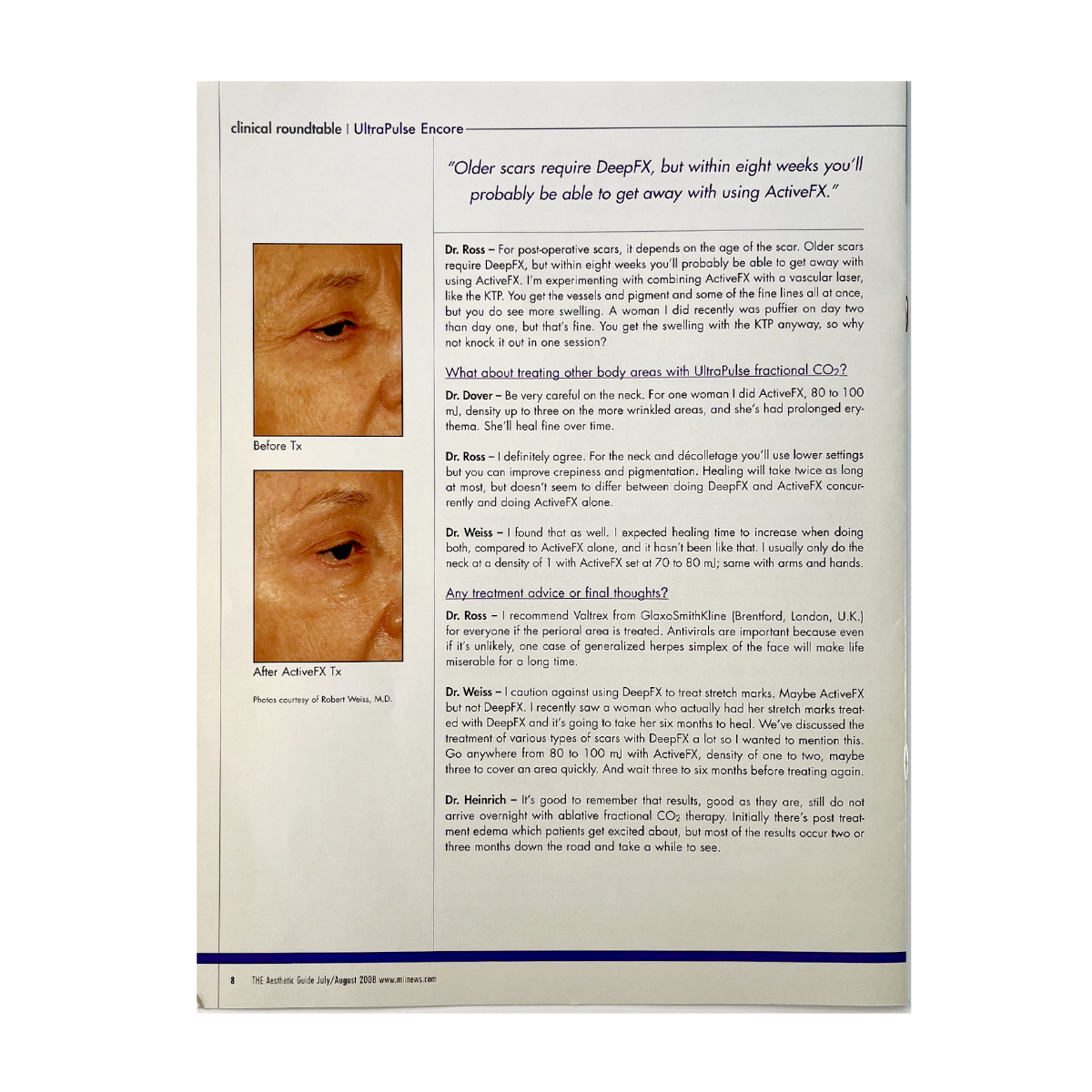 The AESTHETIC Guide, Clinical roundtable Booklet, ”UltraPulse Encore Offers Full Spectrum of Treatment Modalities”. 2008