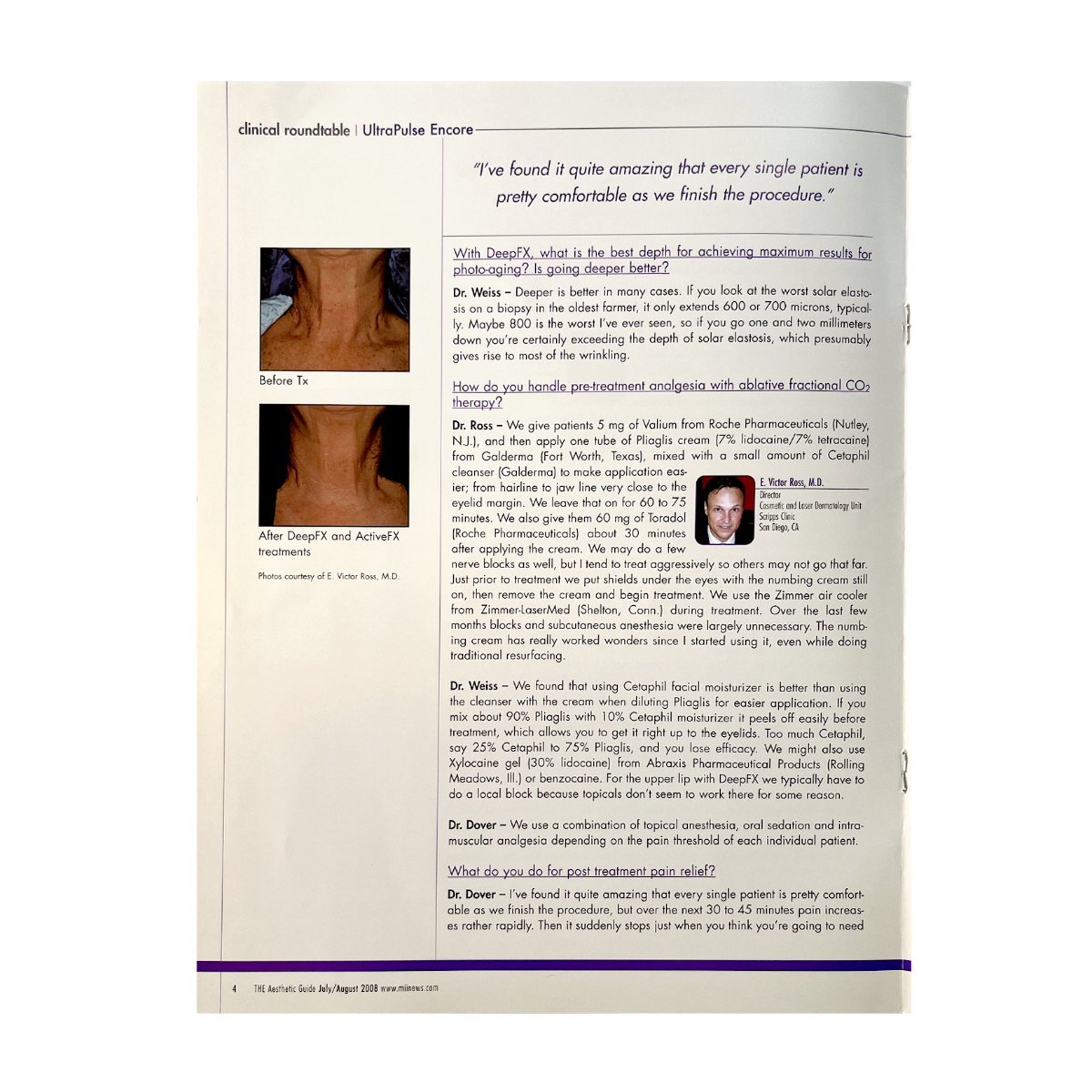 The AESTHETIC Guide, Clinical roundtable Booklet, ”UltraPulse Encore Offers Full Spectrum of Treatment Modalities”. 2008