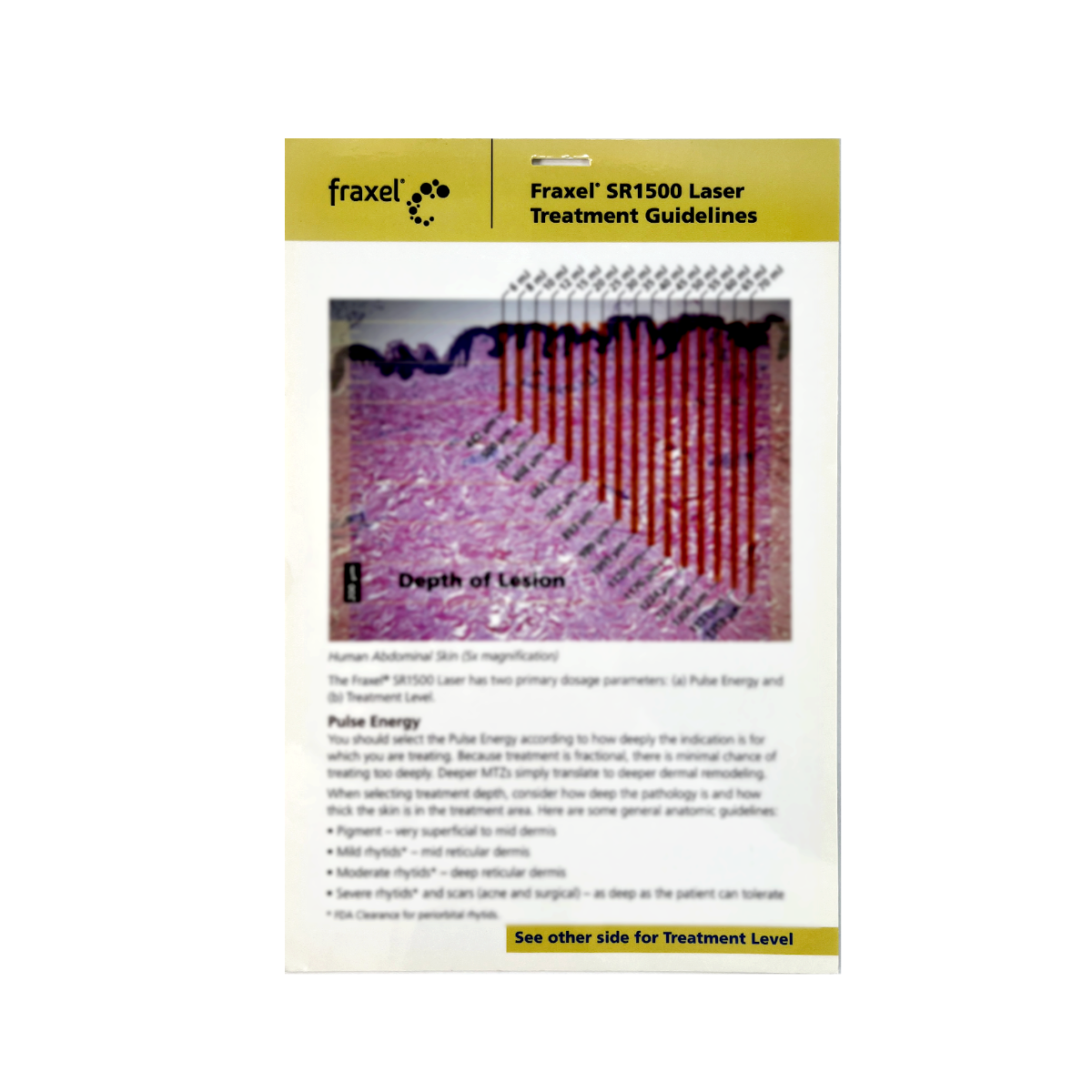 Reliant Technologies, Fraxel SR1500 Laser Treatment Guidelines. P/N: 10-03845 Rev. 2, 2007