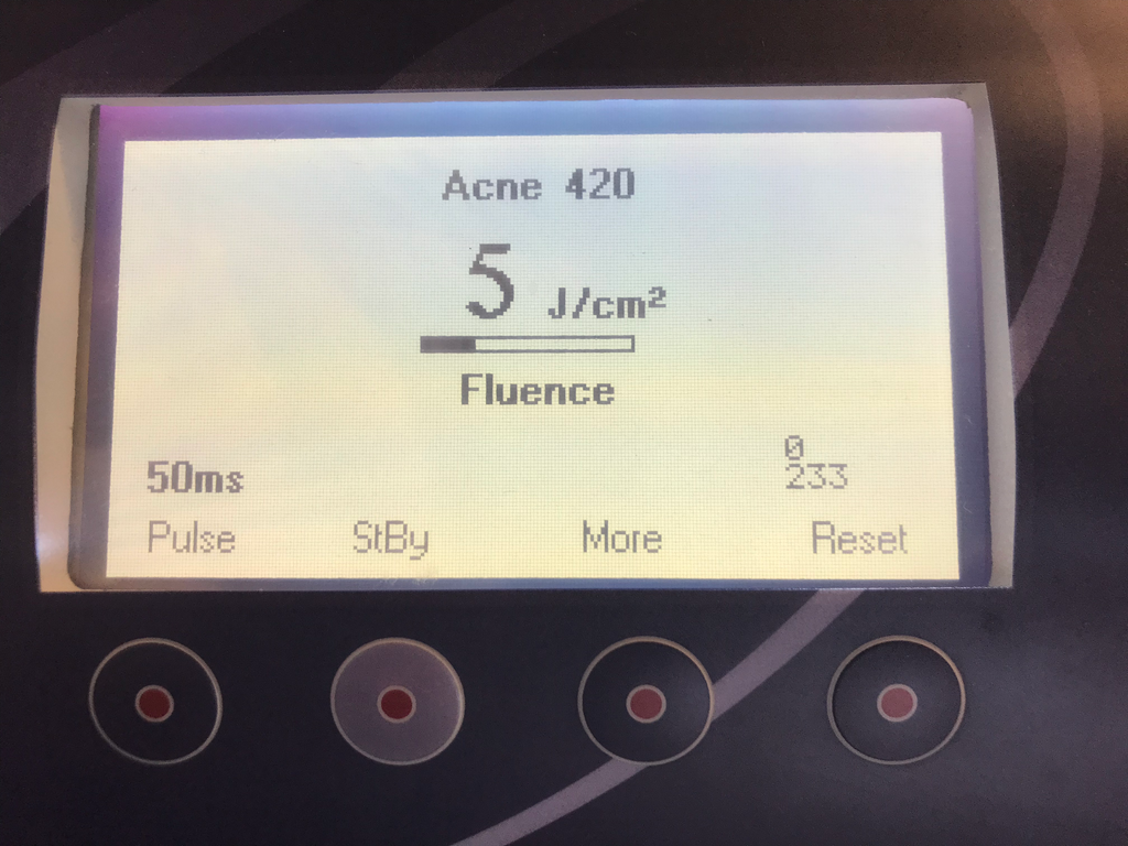 2005 Orion Alma Harmony Aesthetic IPL Laser 5 HPs Veins Pigment Acne