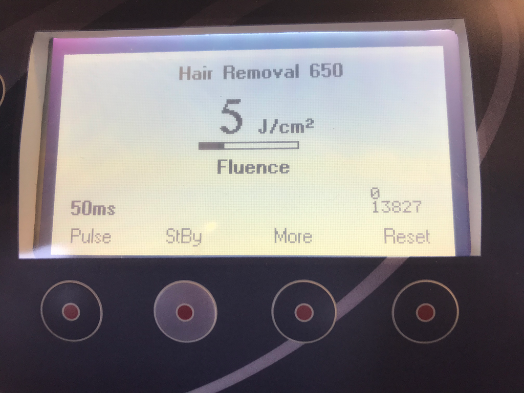2005 Orion Alma Harmony Aesthetic IPL Laser 5 HPs Veins Pigment Acne