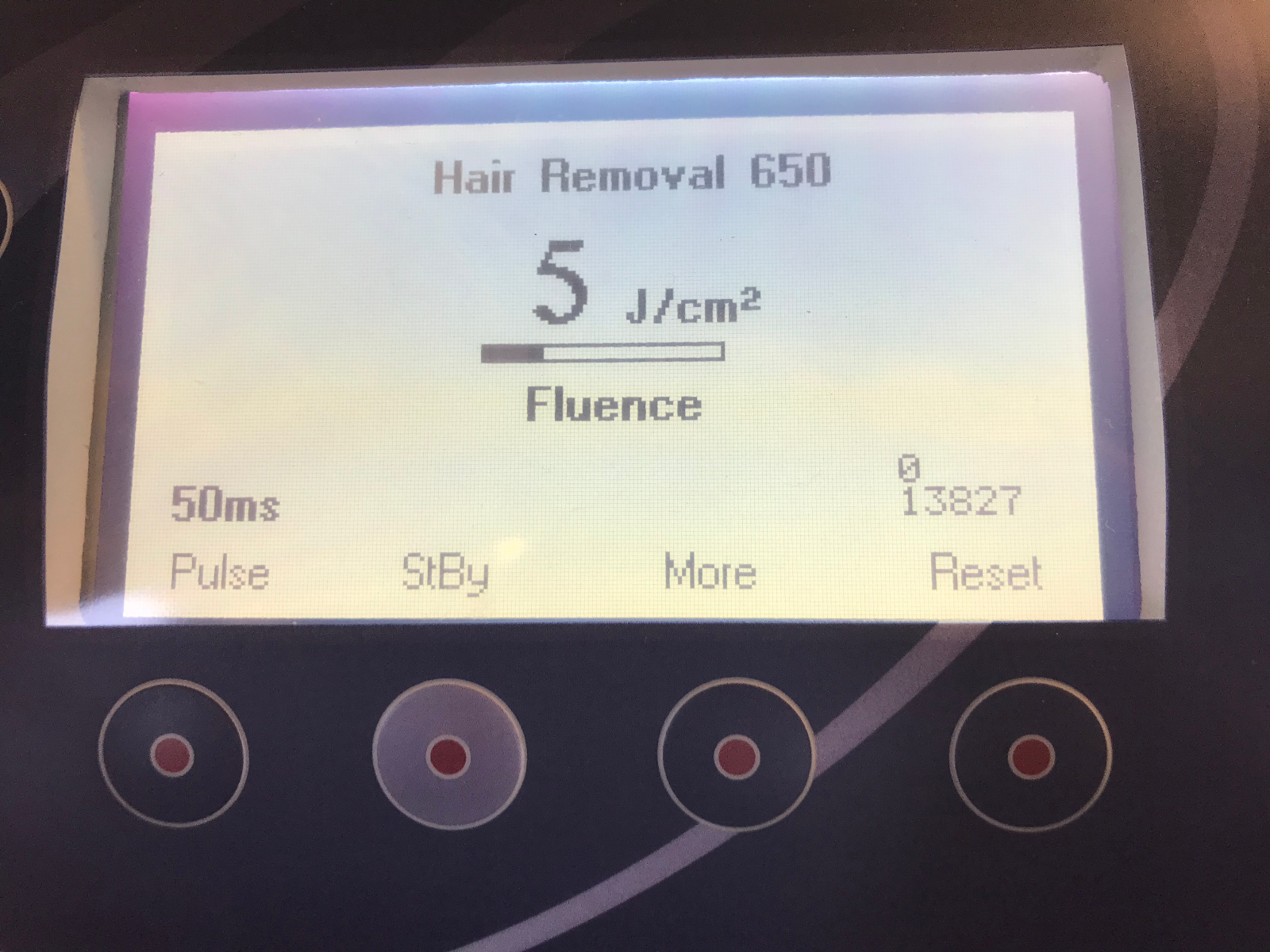 2005 Orion Alma Harmony Aesthetic IPL Laser 5 HPs Veins Pigment Acne