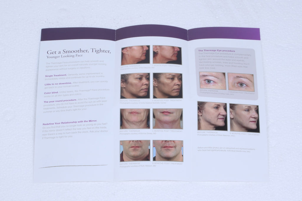 Solta Thermage Live Beautifully RF Face Tightening Patient Marketing Brochures