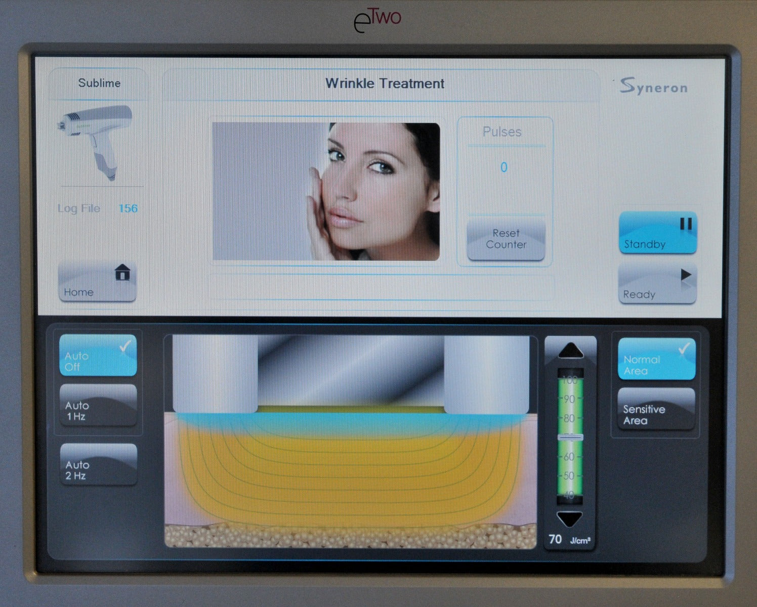 Candela Syneron eTwo eMatrix IR RF Cosmetic Laser Wrinkles Acne Stretch e2 E 2