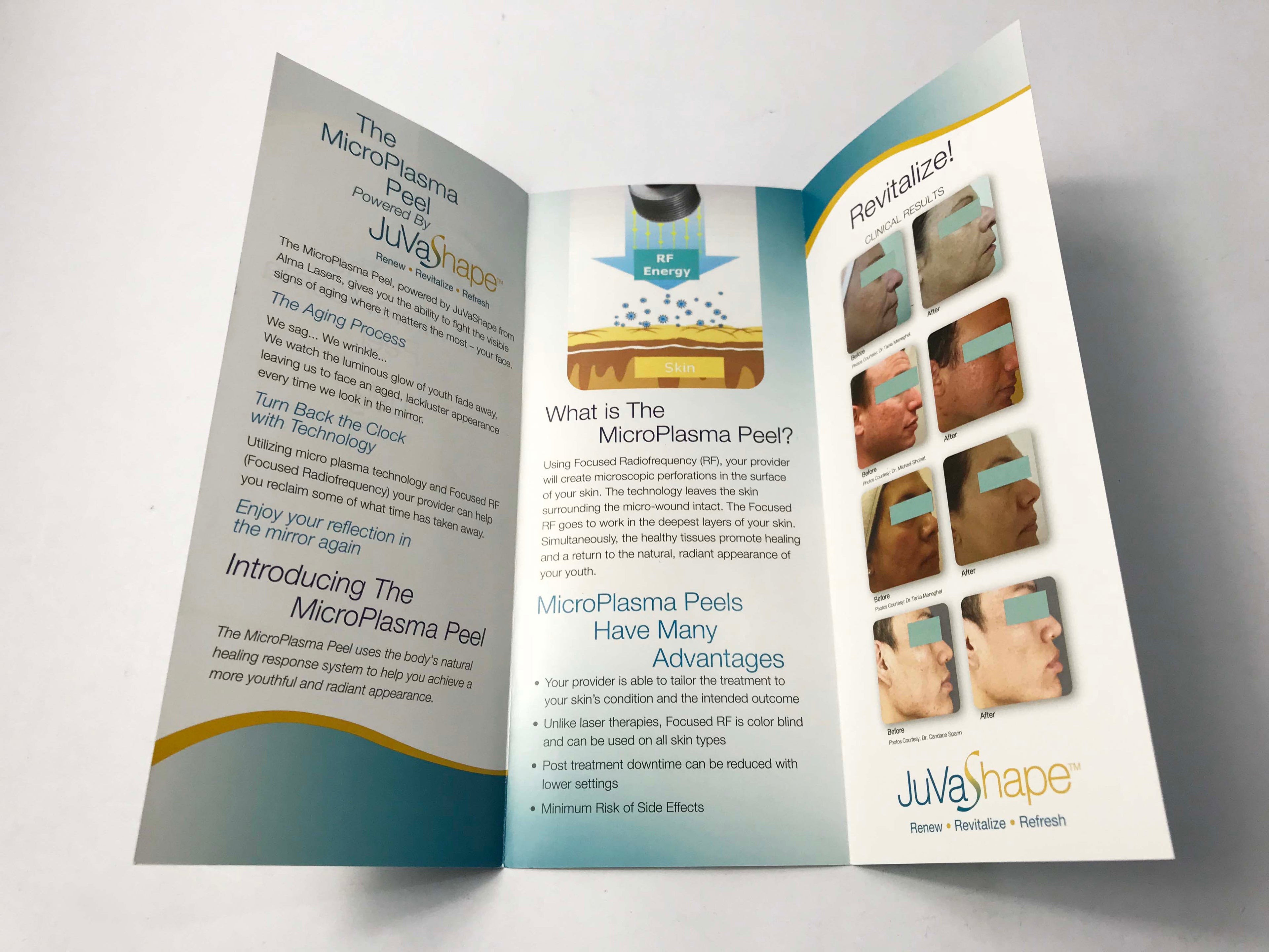 Alma JuvaShape MicroPlasma Peel RF Anti Aging Treatment Patient Brochures 20Pack