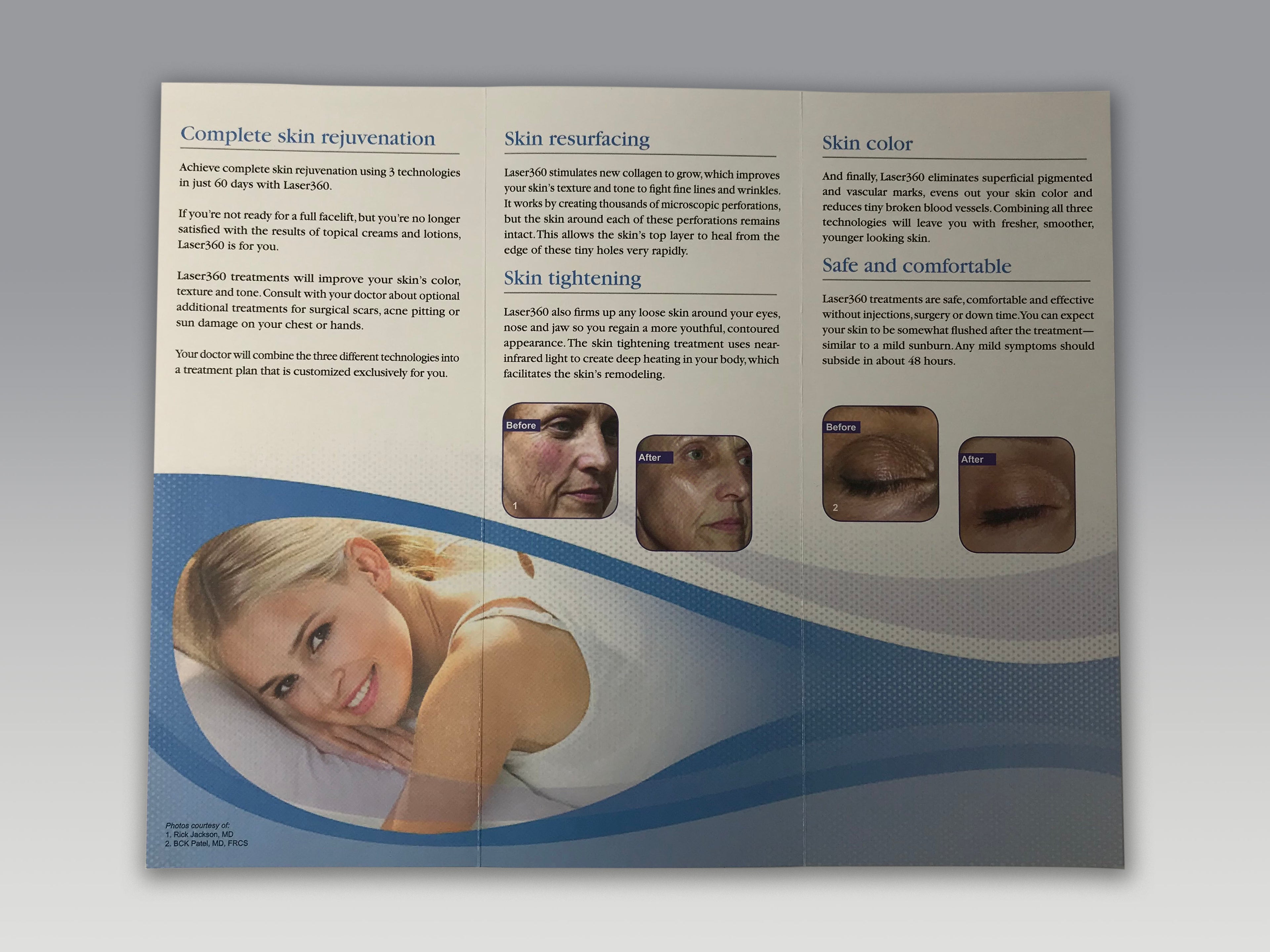 Alma Laser 360 Customized Laser360 Complete Skin Rejuvenation Plan Brochures