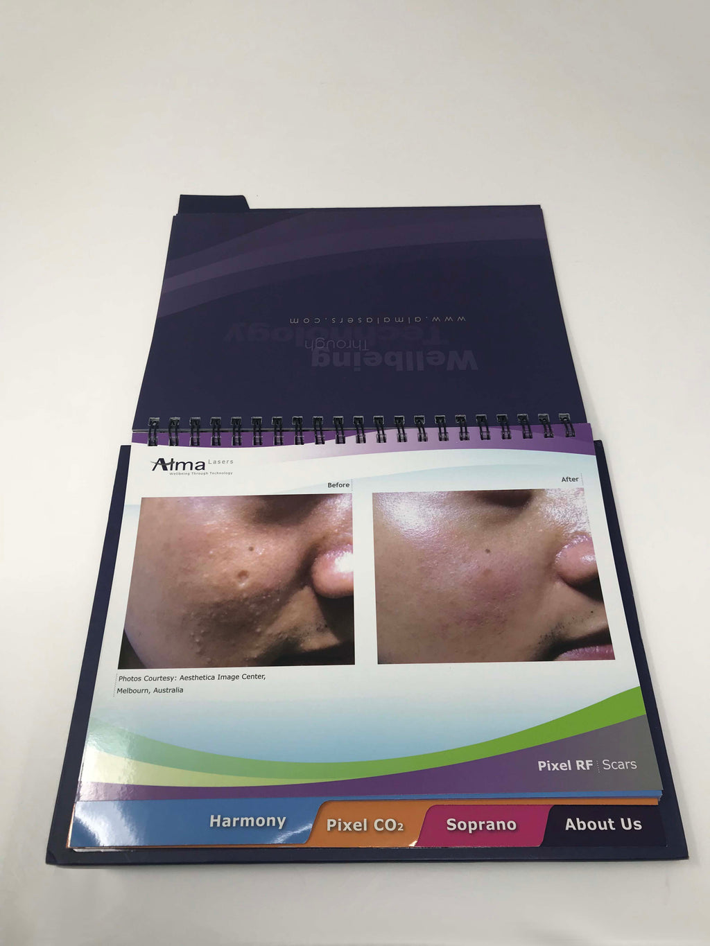 Alma Laser Platforms Case Studies Presentation Book Accent Harmony Pixel Soprano
