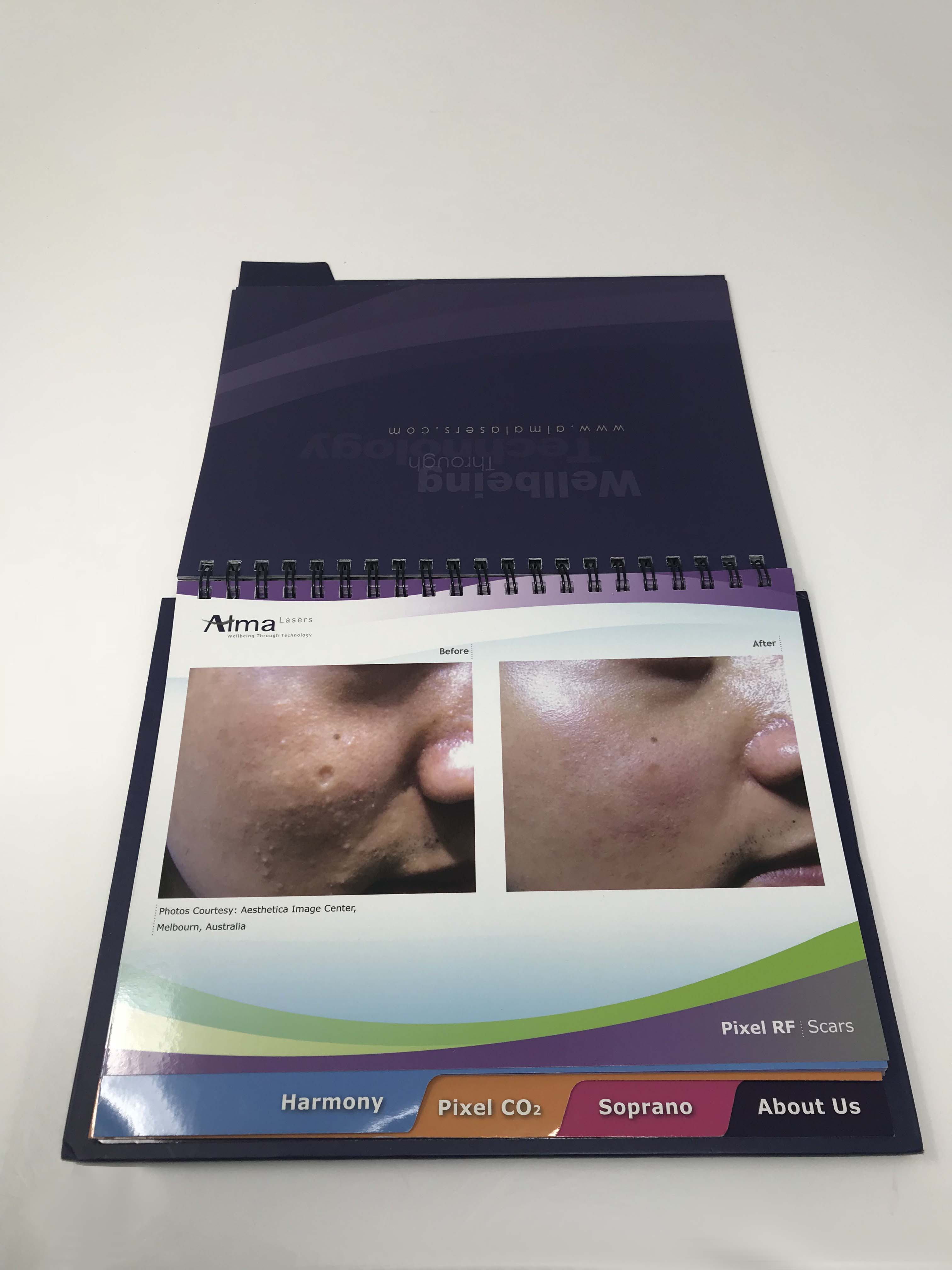 Alma Laser Platforms Case Studies Presentation Book Accent Harmony Pixel Soprano