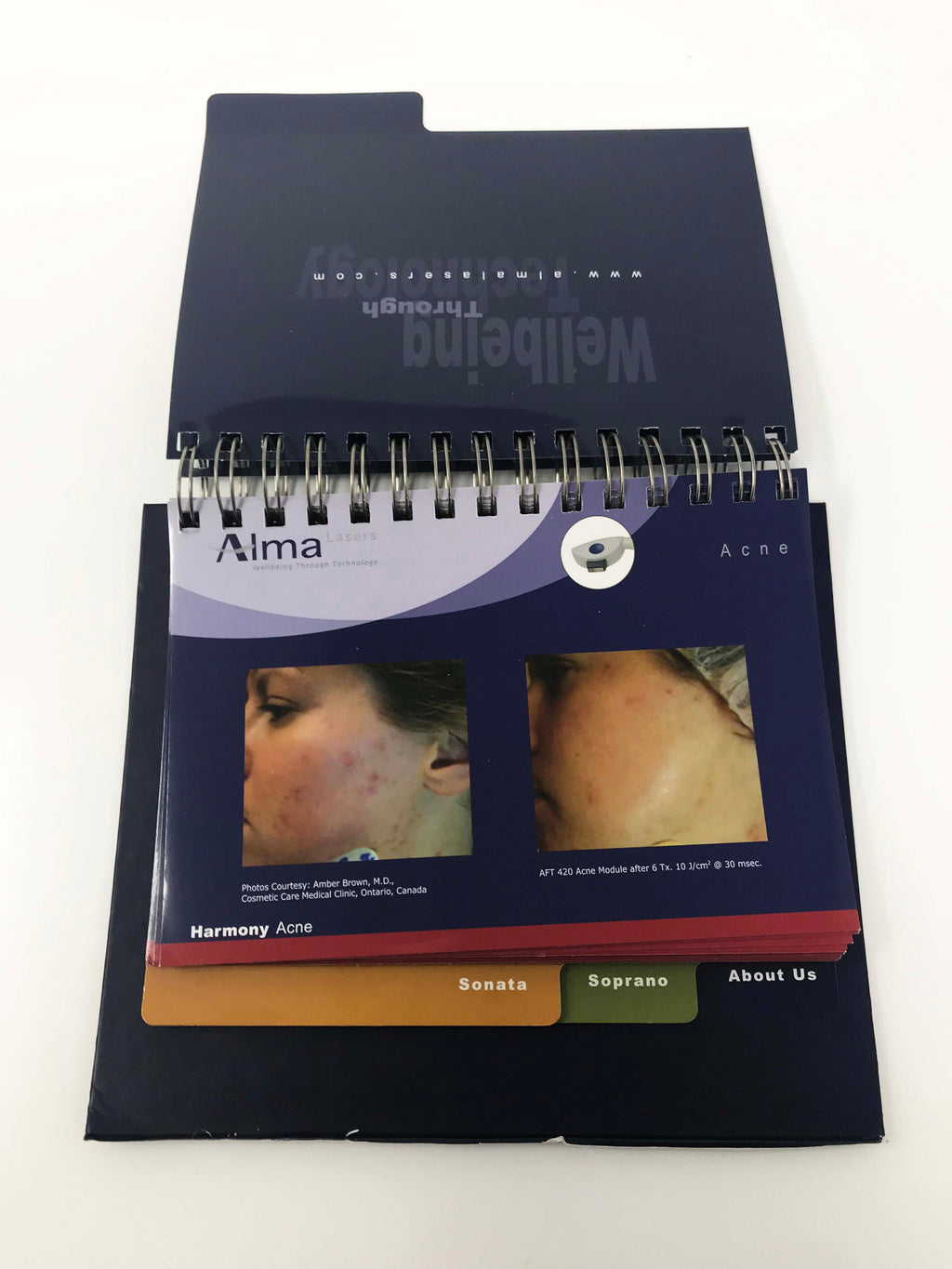 ALMA LASERS Aesthetics Case Studies Patient Before & After Presentation Book