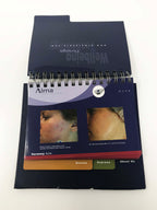 ALMA LASERS Aesthetics Case Studies Patient Before & After Presentation Book