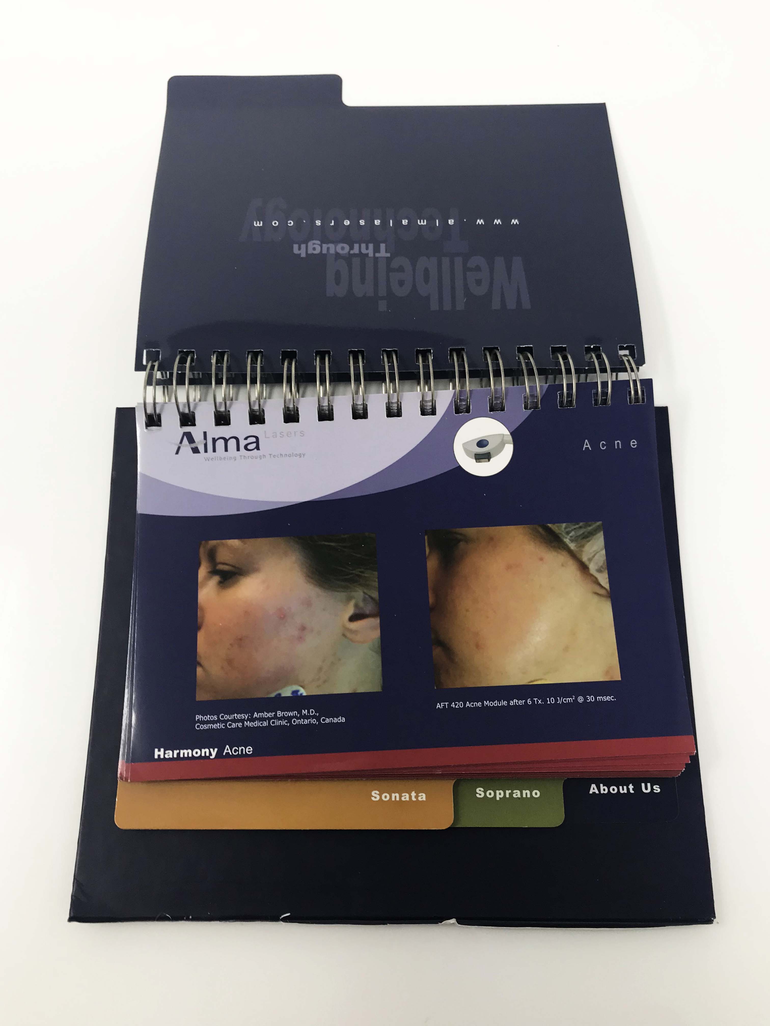 ALMA LASERS Aesthetics Case Studies Patient Before & After Presentation Book
