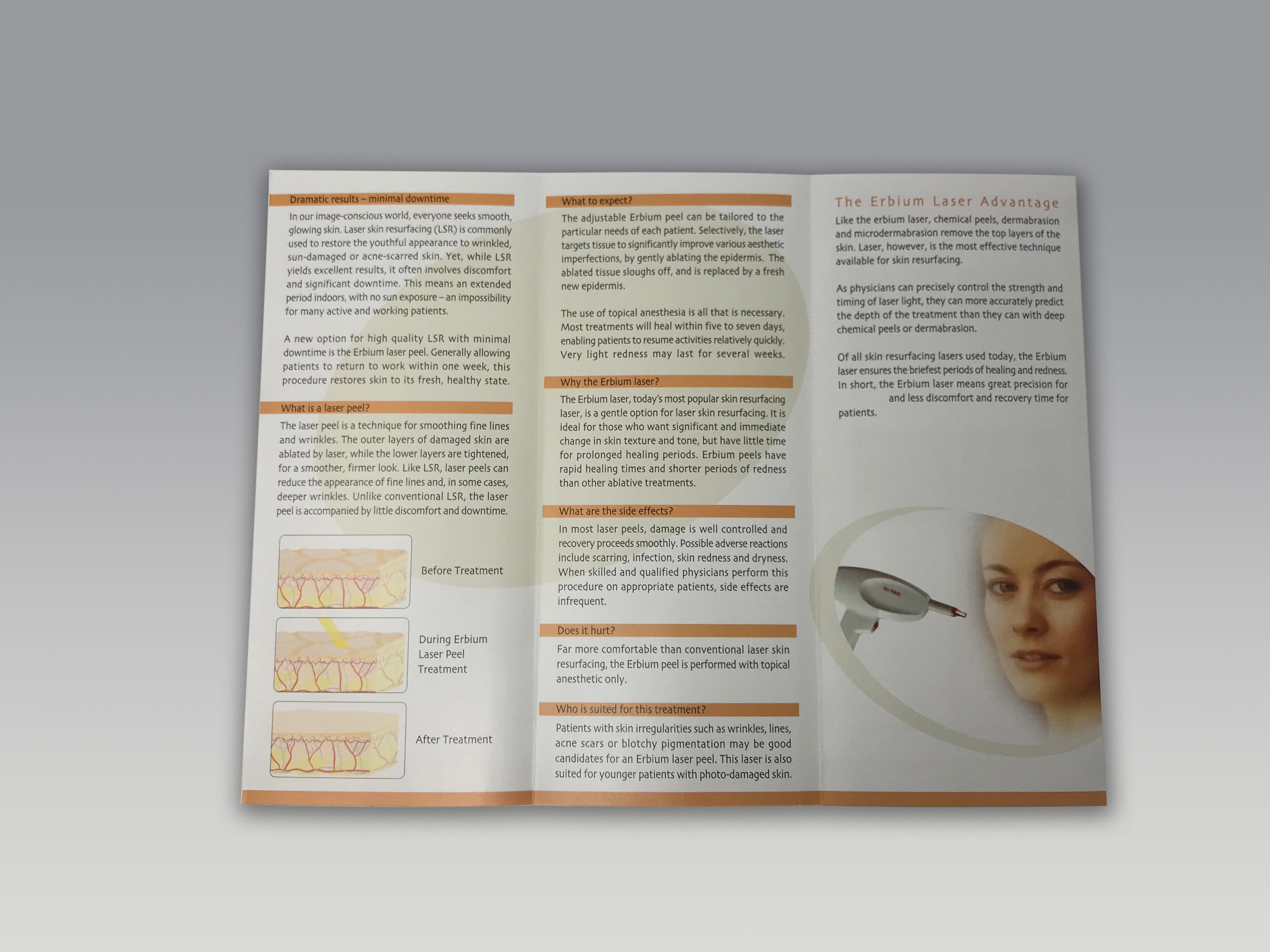 Alma Lasers Er YAG Gentle Peel Erbium Laser Skin Resurfacing Patient Brochures