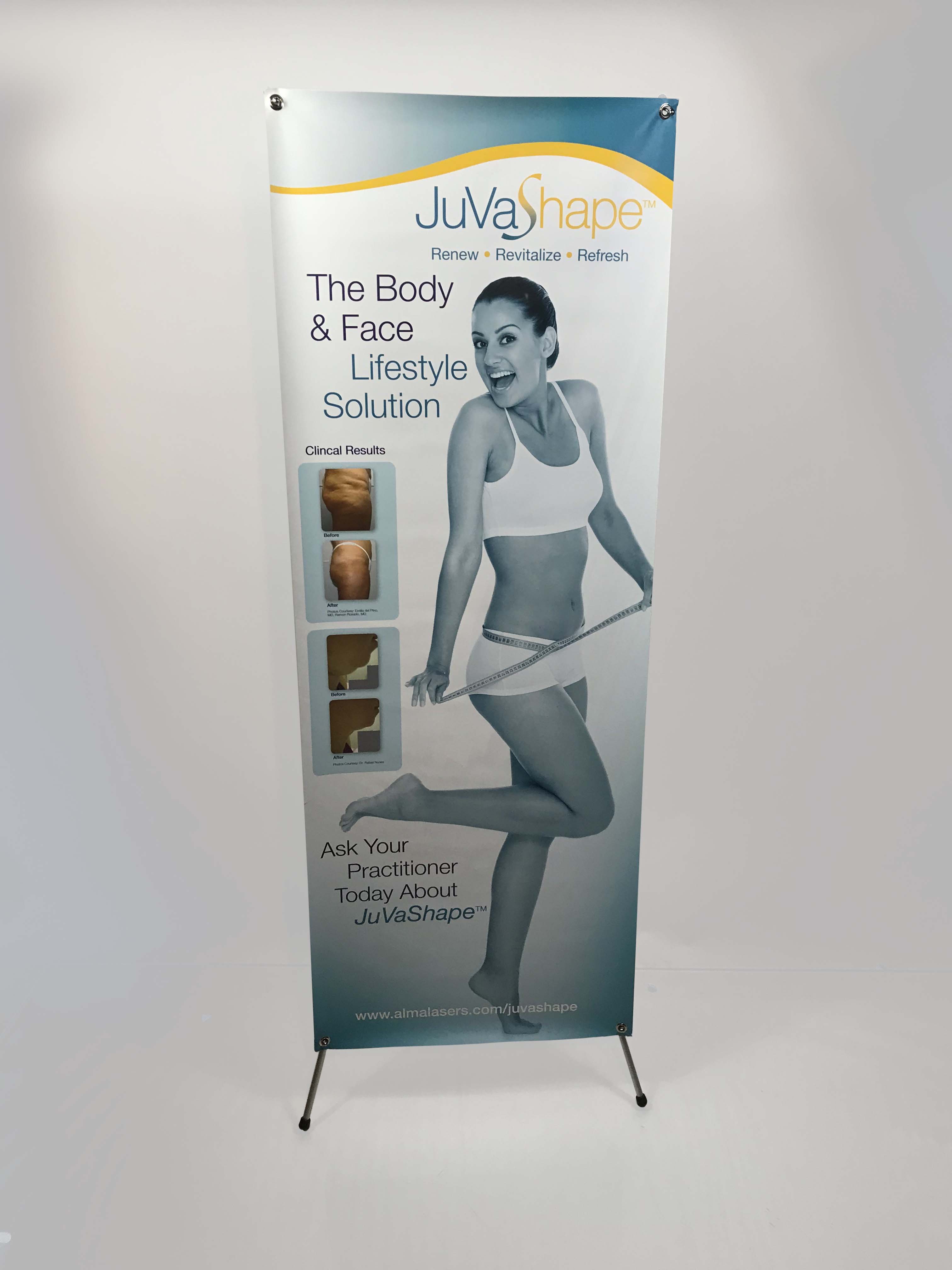 Alma Lasers JuvaShape Procedure Vinyl Marketing Banner & Stand 23x62 Inch