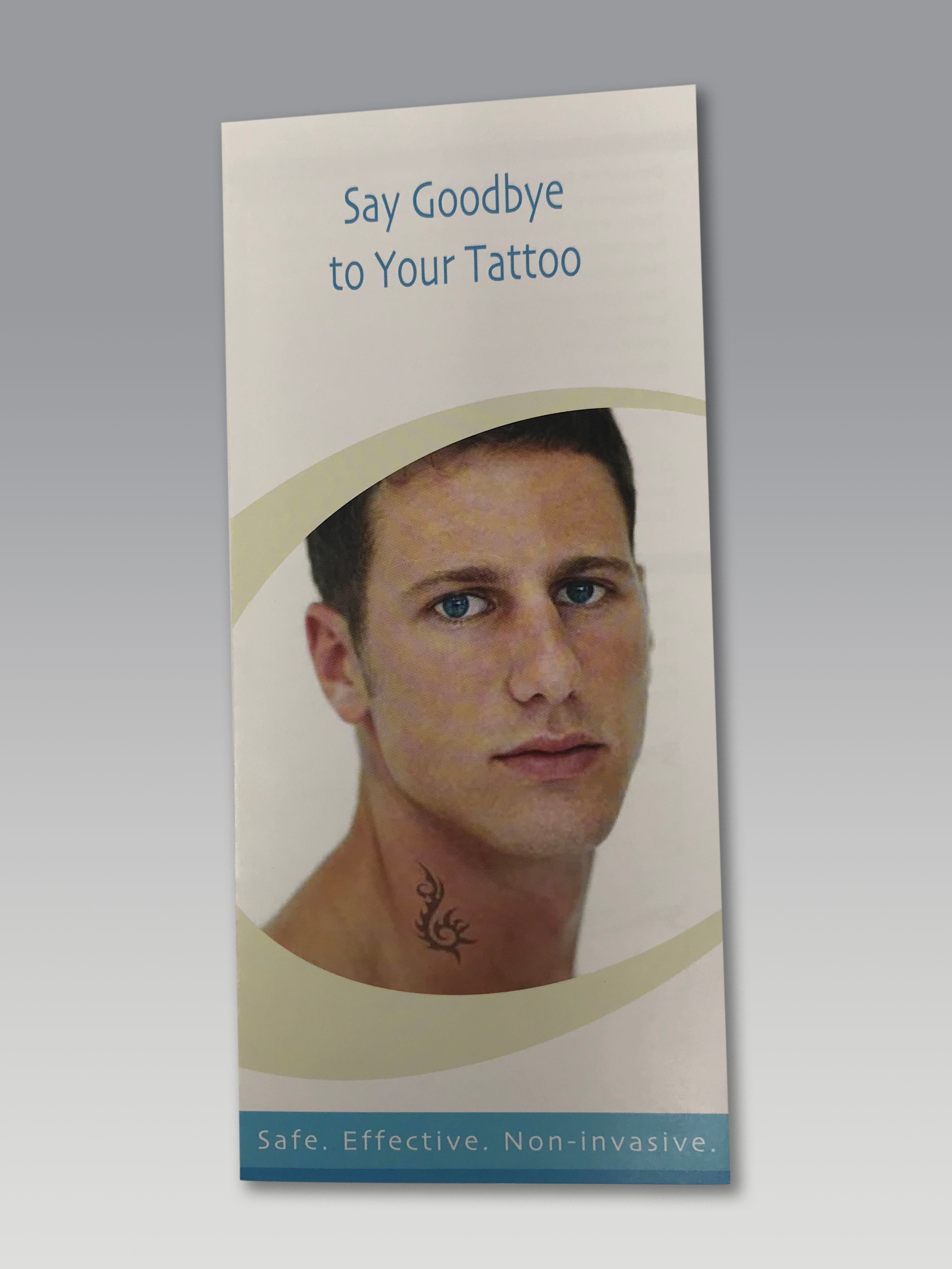 Alma Lasers QS Nd YAG Q-Switched Laser Tattoo Removal Patient Brochures 38-Pack