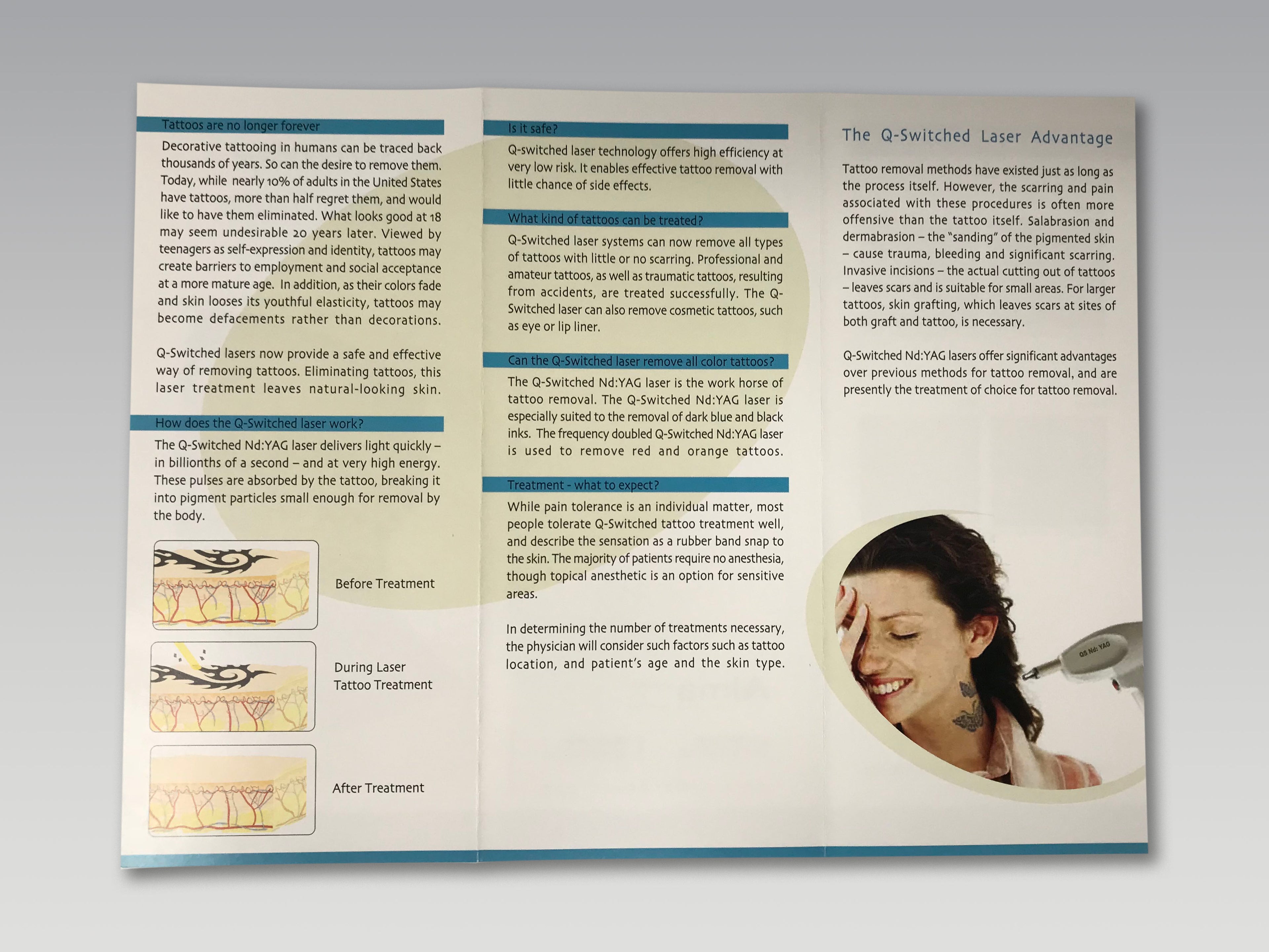 Alma Lasers QS Nd YAG Q-Switched Laser Tattoo Removal Patient Brochures 38-Pack