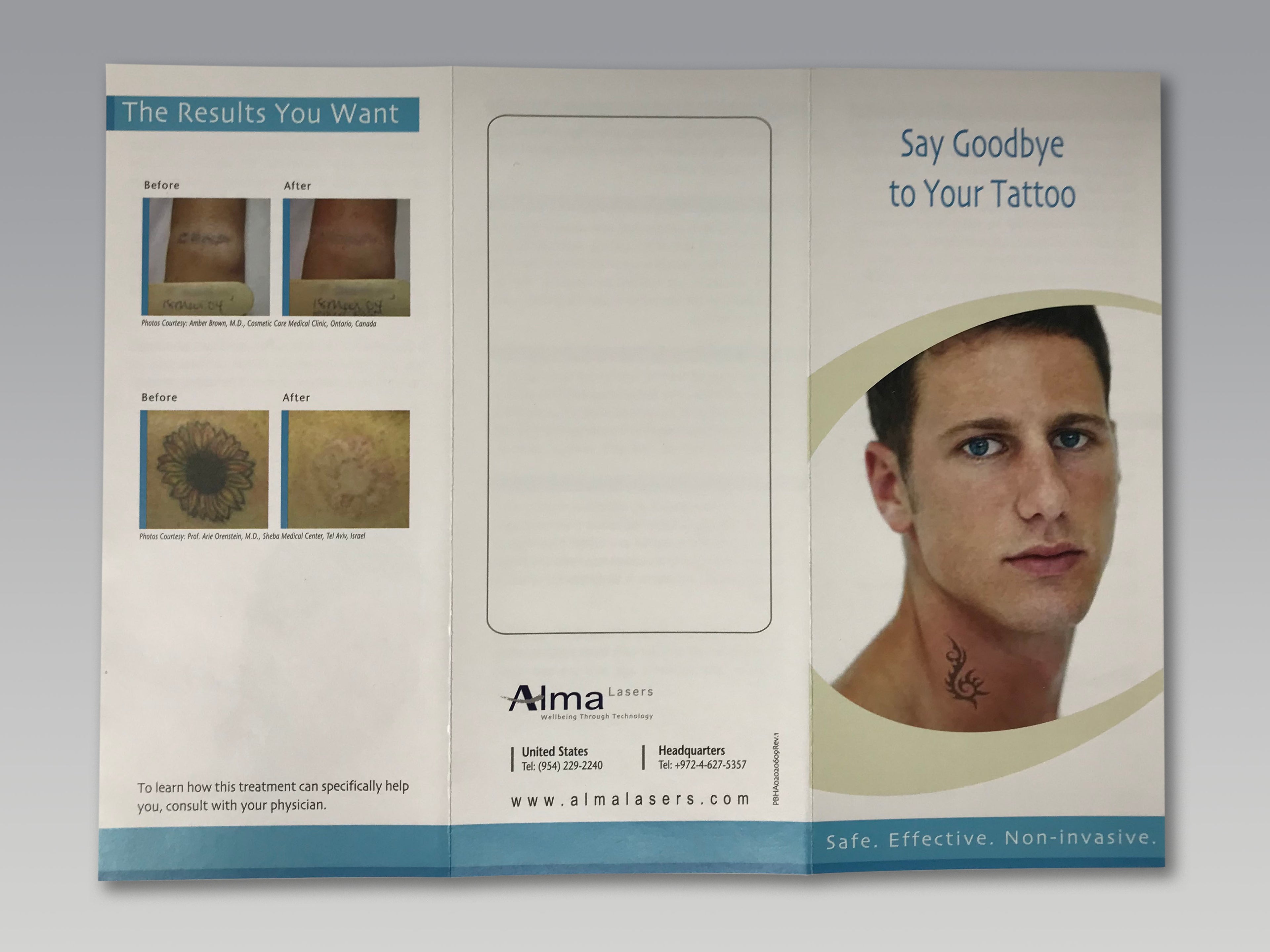 Alma Lasers QS Nd YAG Q-Switched Laser Tattoo Removal Patient Brochures 38-Pack