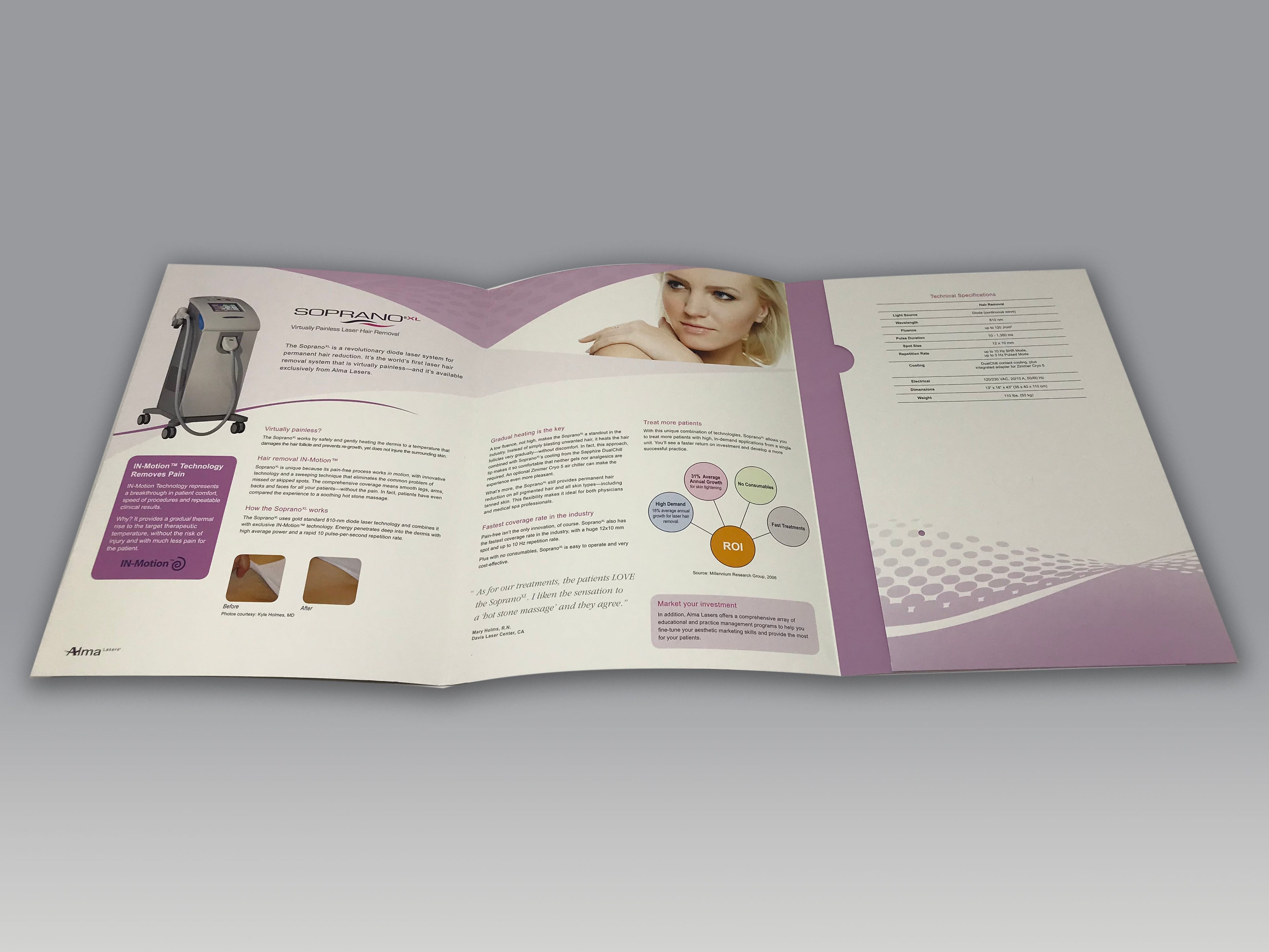 ALMA Soprano XL Laser Hair Removal Platform Marketing Outline Sales Brochure