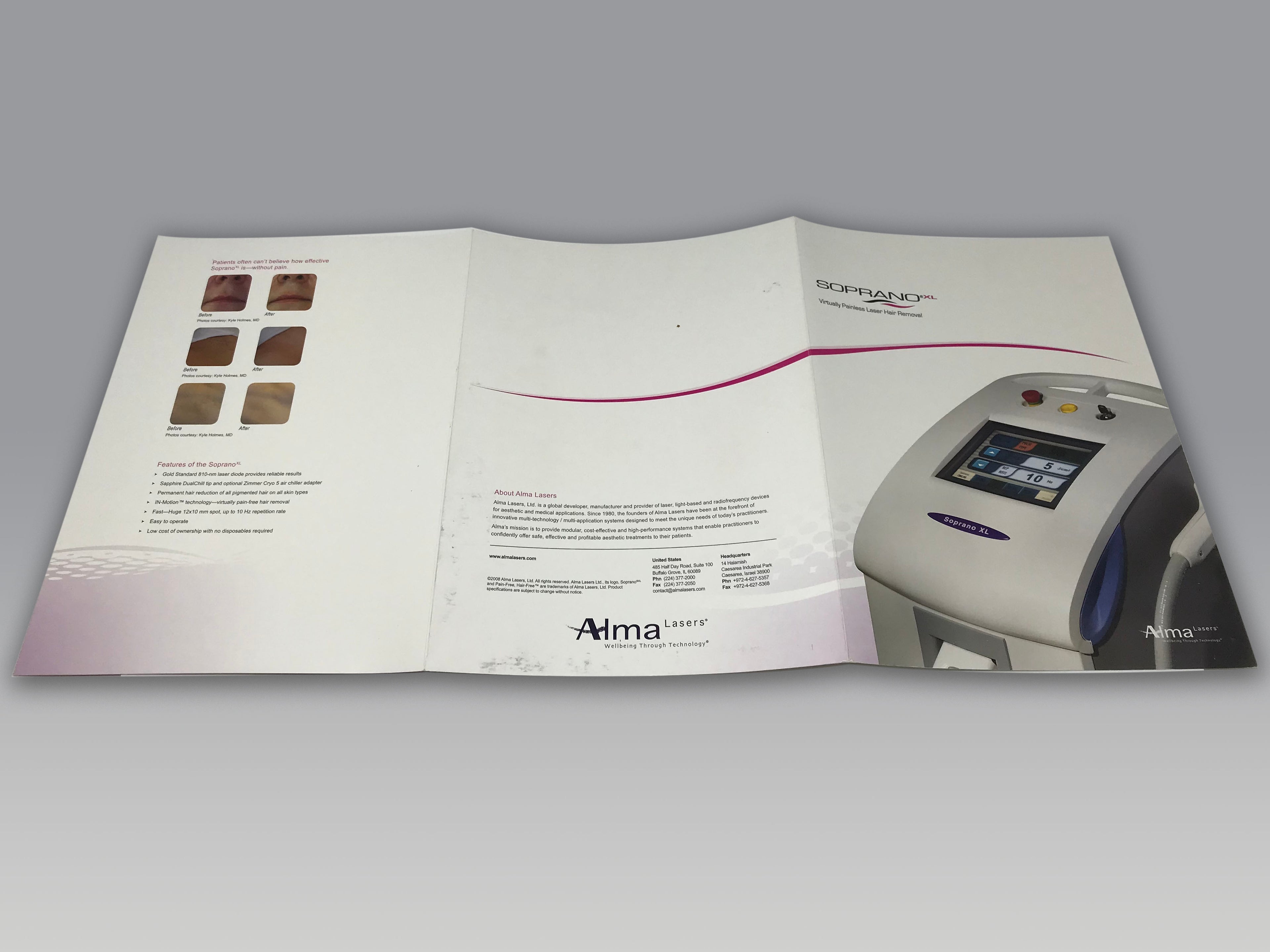 ALMA Soprano XL Laser Hair Removal Platform Marketing Outline Sales Brochure