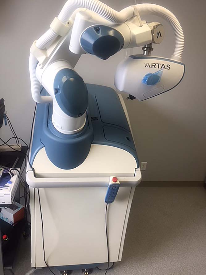 Venus Concept Artas Robotics Hair Follicle Restoration Robotics Transplant