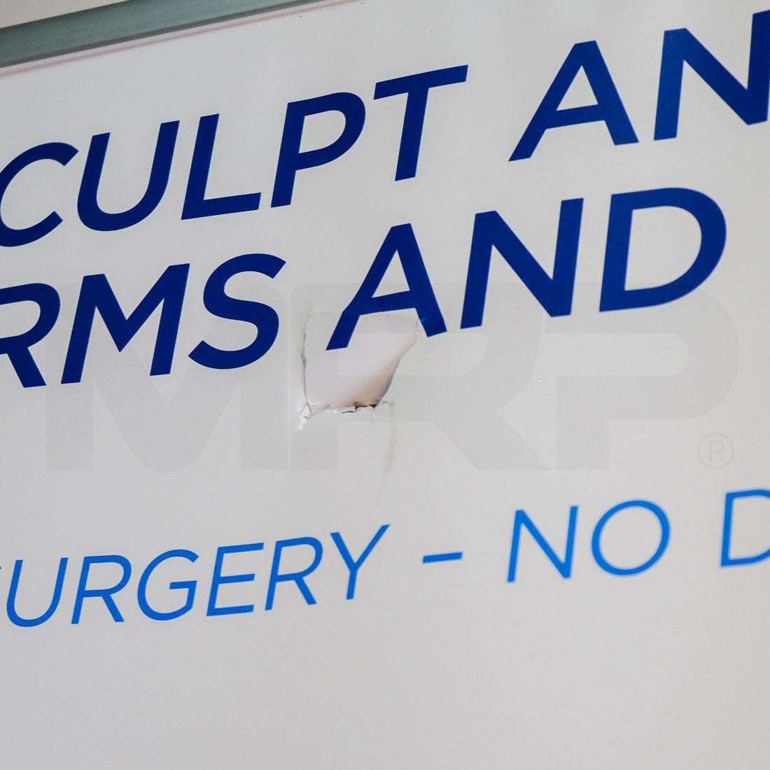BTL EMSculpt "Sculpt and Tone Arms and Legs" Marketing Banner Hole
