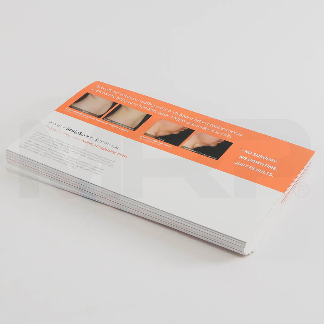 Cynosure SculpSure "Smarter Way to Sculpt" Patient Marketing Postcard Back
