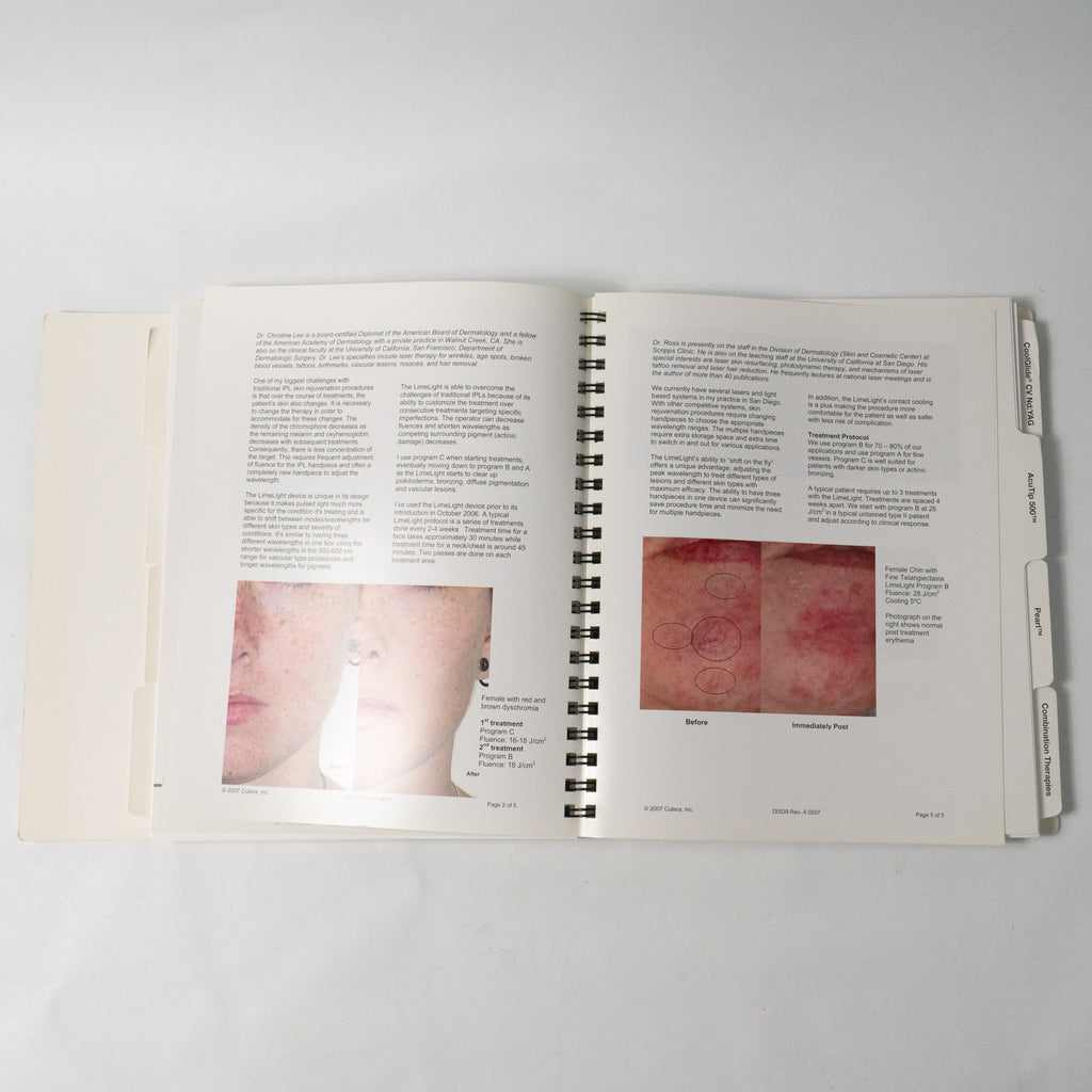 Cutera XEO CoolGlide Solera Laser Workshop Material Handbook Hair Removal Lesion