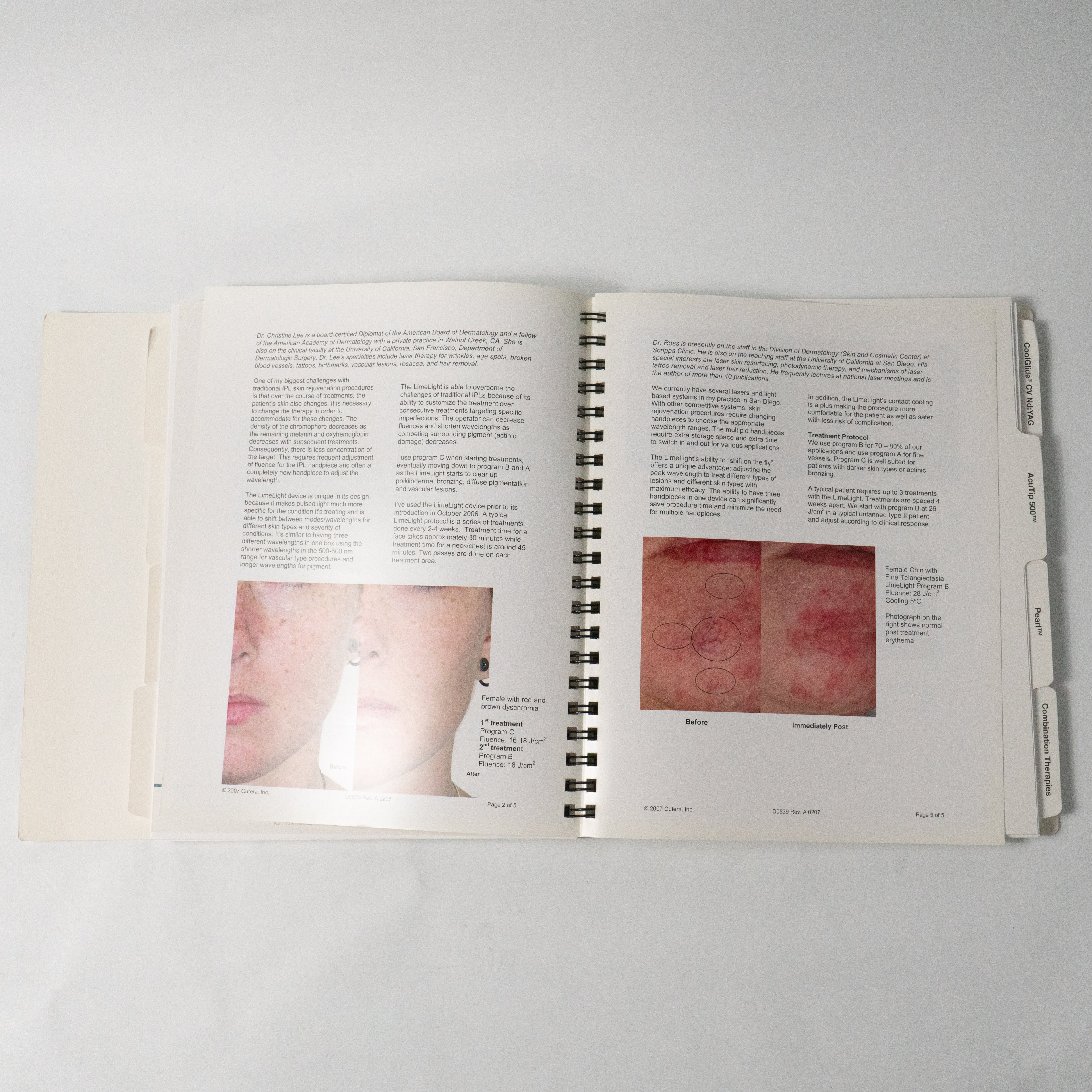 Cutera XEO CoolGlide Solera Laser Workshop Material Handbook Hair Removal Lesion