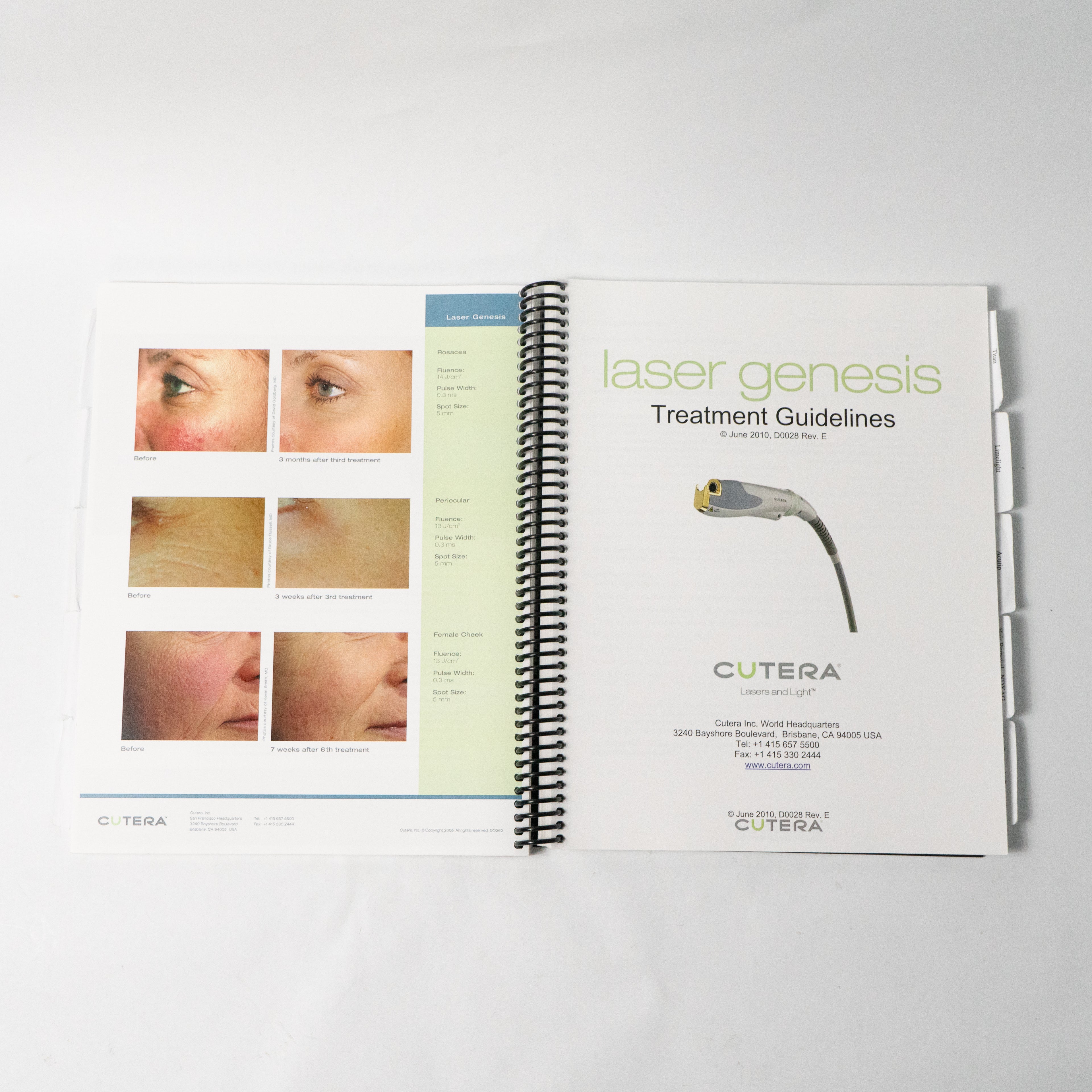 CUTERA Xeo Treatment Guideline Handbook Pearl Genesis Titan LimeLight Acutip ECT