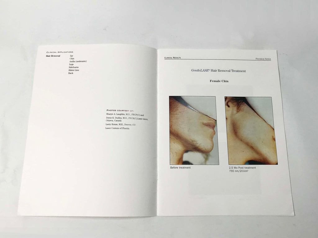 Candela GentleLase Laser Hair Removal Clinical Results B&A Marketing Photo Book