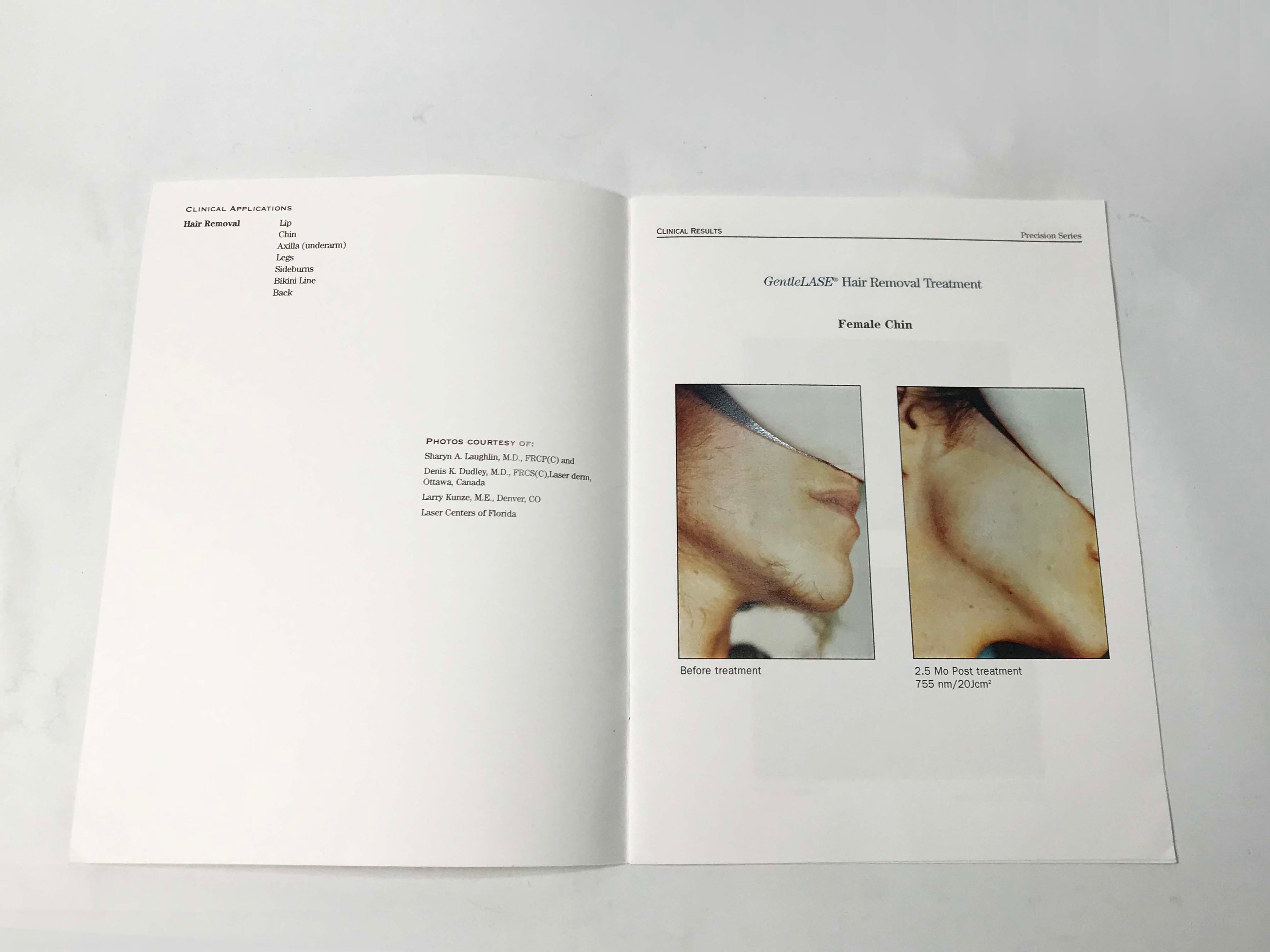 Candela GentleLase Laser Hair Removal Clinical Results B&A Marketing Photo Book