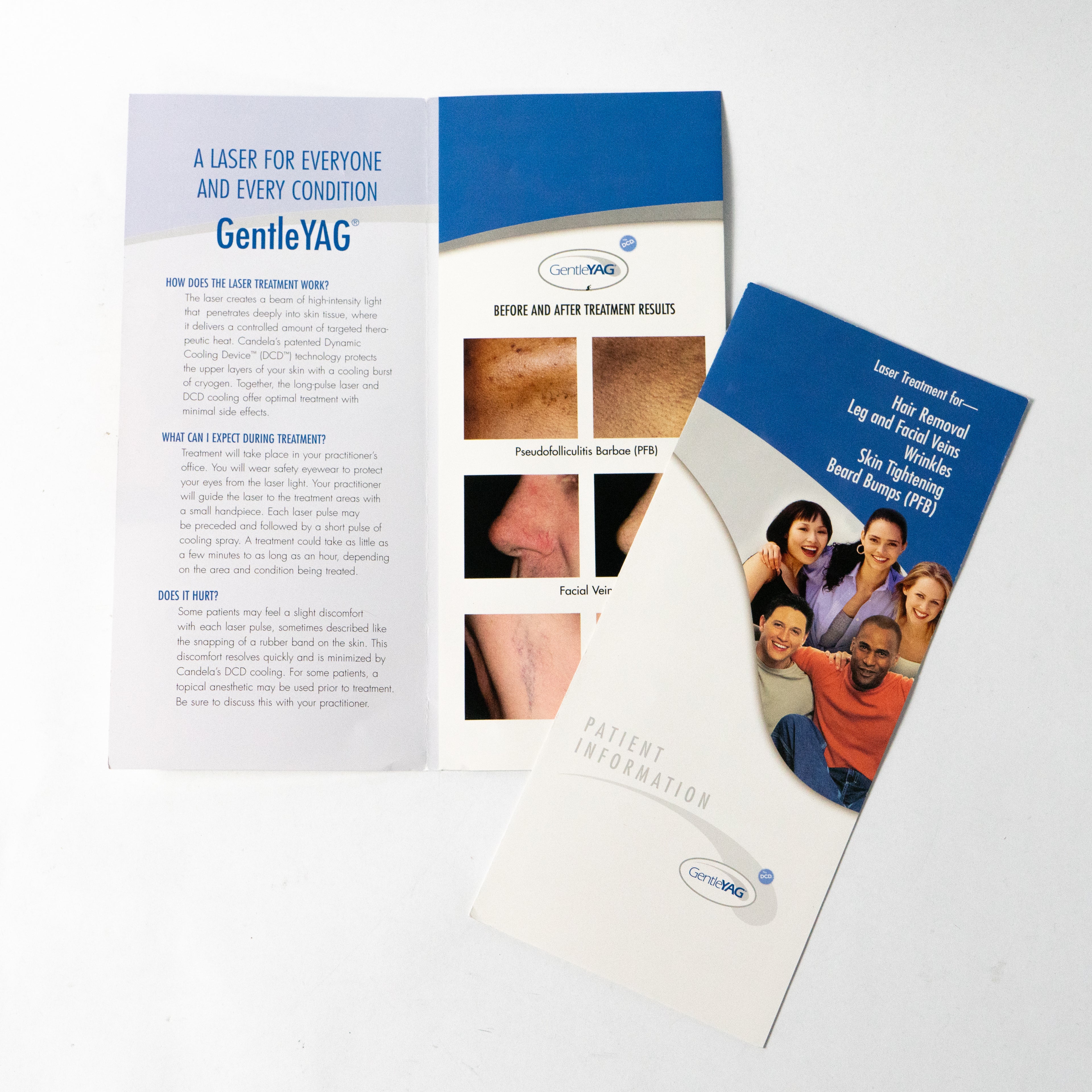 Candela Lasers - GentleLASE, GentleYAG Patient Information Brochures