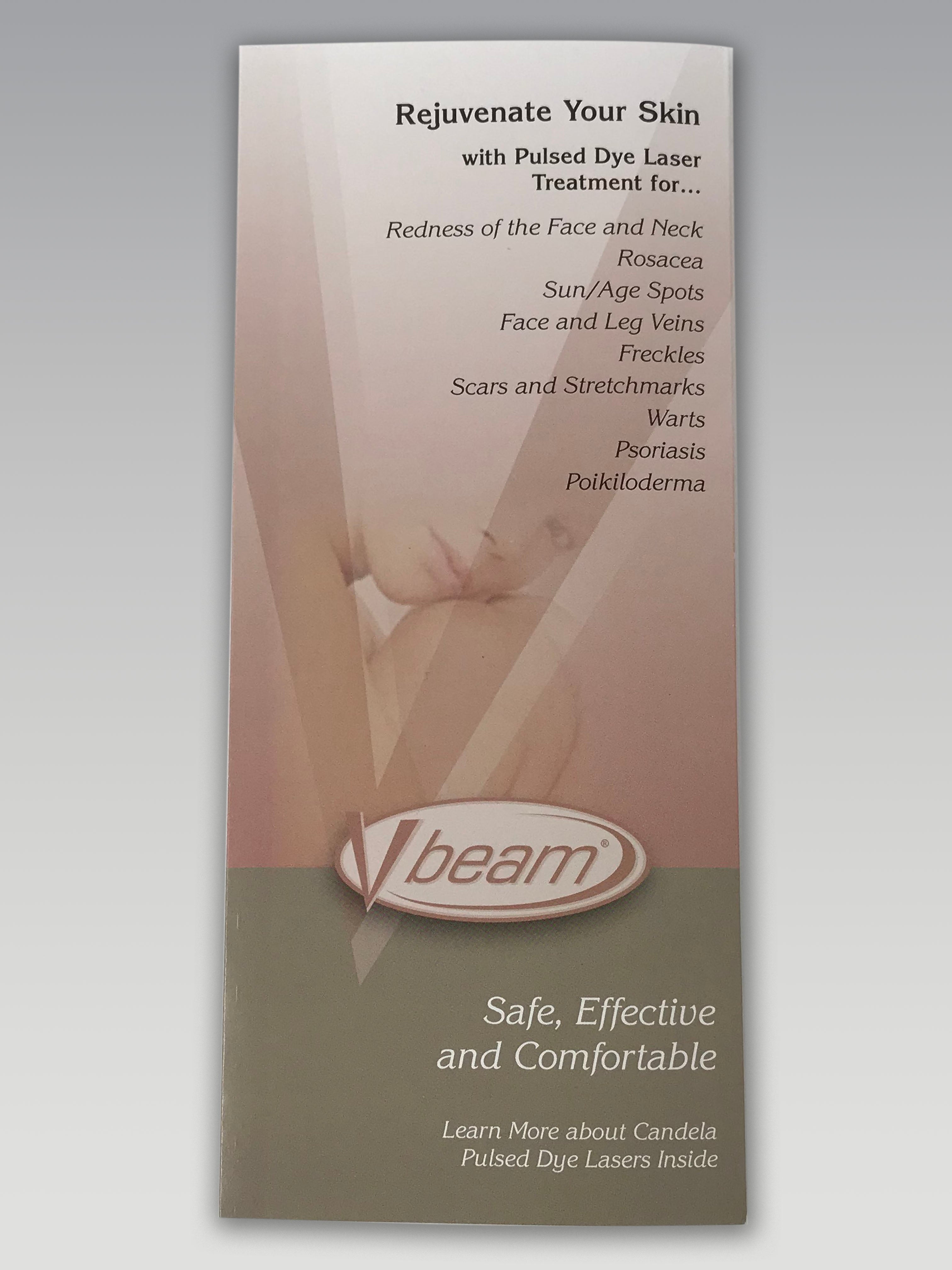 Candela Vbeam Pulsed Dye V Beam Perfecta Skin Rejuvenation Laser B&A Brochures