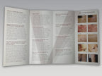 Candela Vbeam Pulsed Dye V Beam Perfecta Skin Rejuvenation Laser B&A Brochures