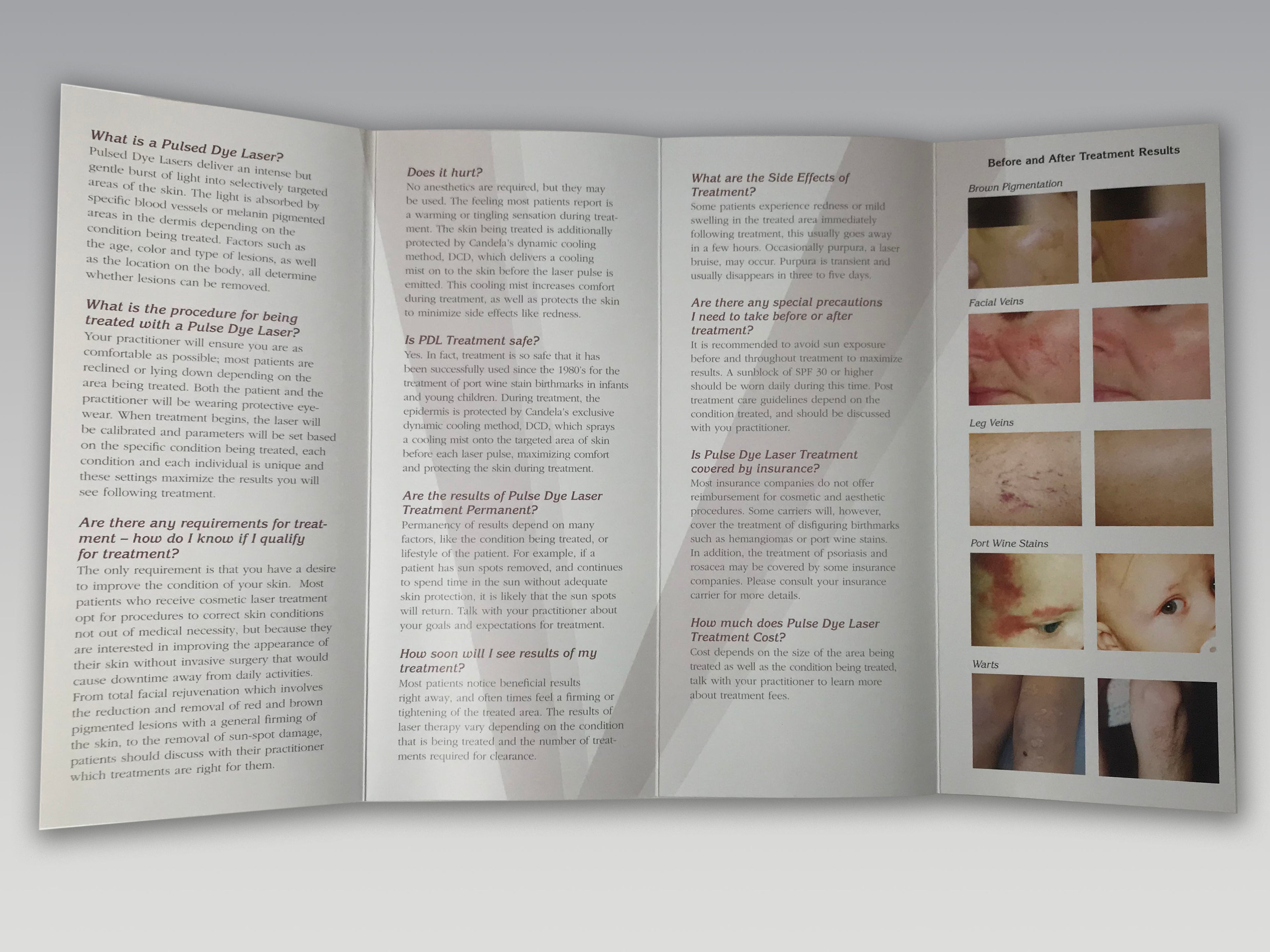 Candela Vbeam Pulsed Dye V Beam Perfecta Skin Rejuvenation Laser B&A Brochures
