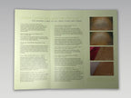 Cutera CoolGlide Laser Cool Glide Nd YAG 1064 Hair Removal Patient Brochures