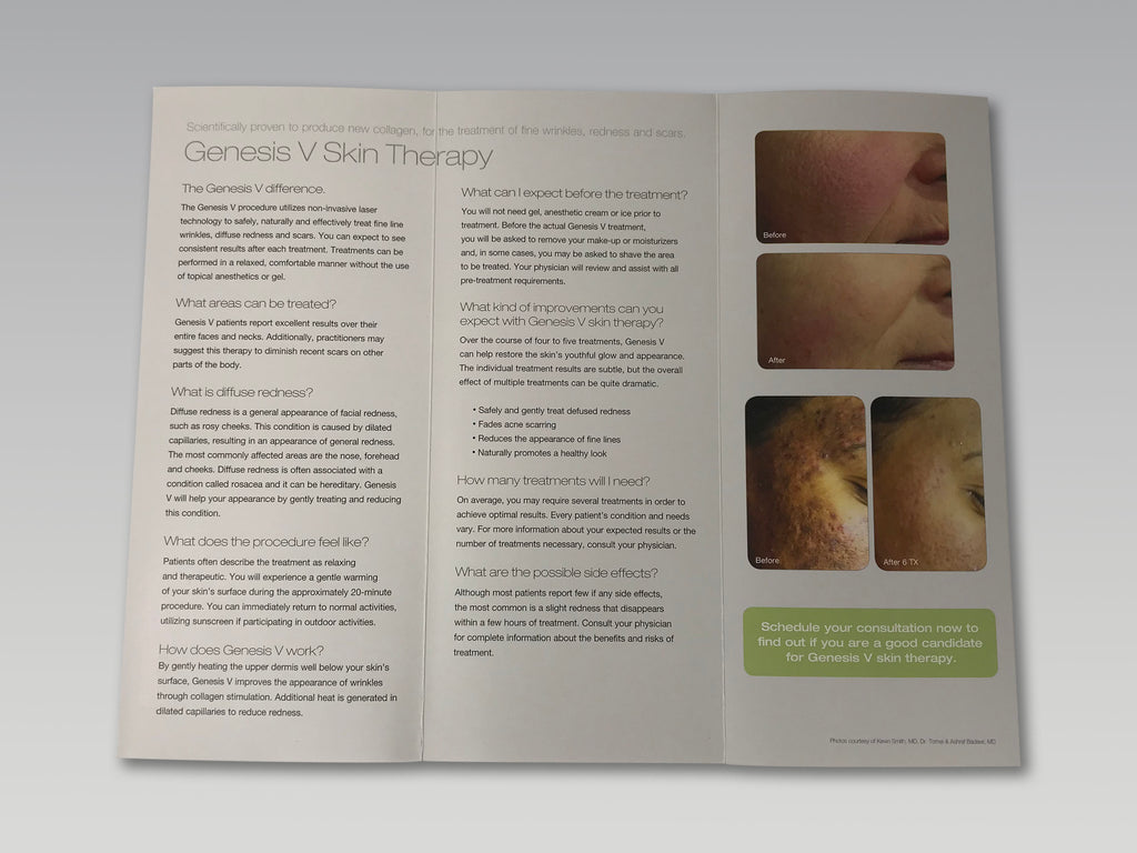 Cutera Excel V Genesis V Laser Redness Wrinkles Scars Treatment Patient Brochure