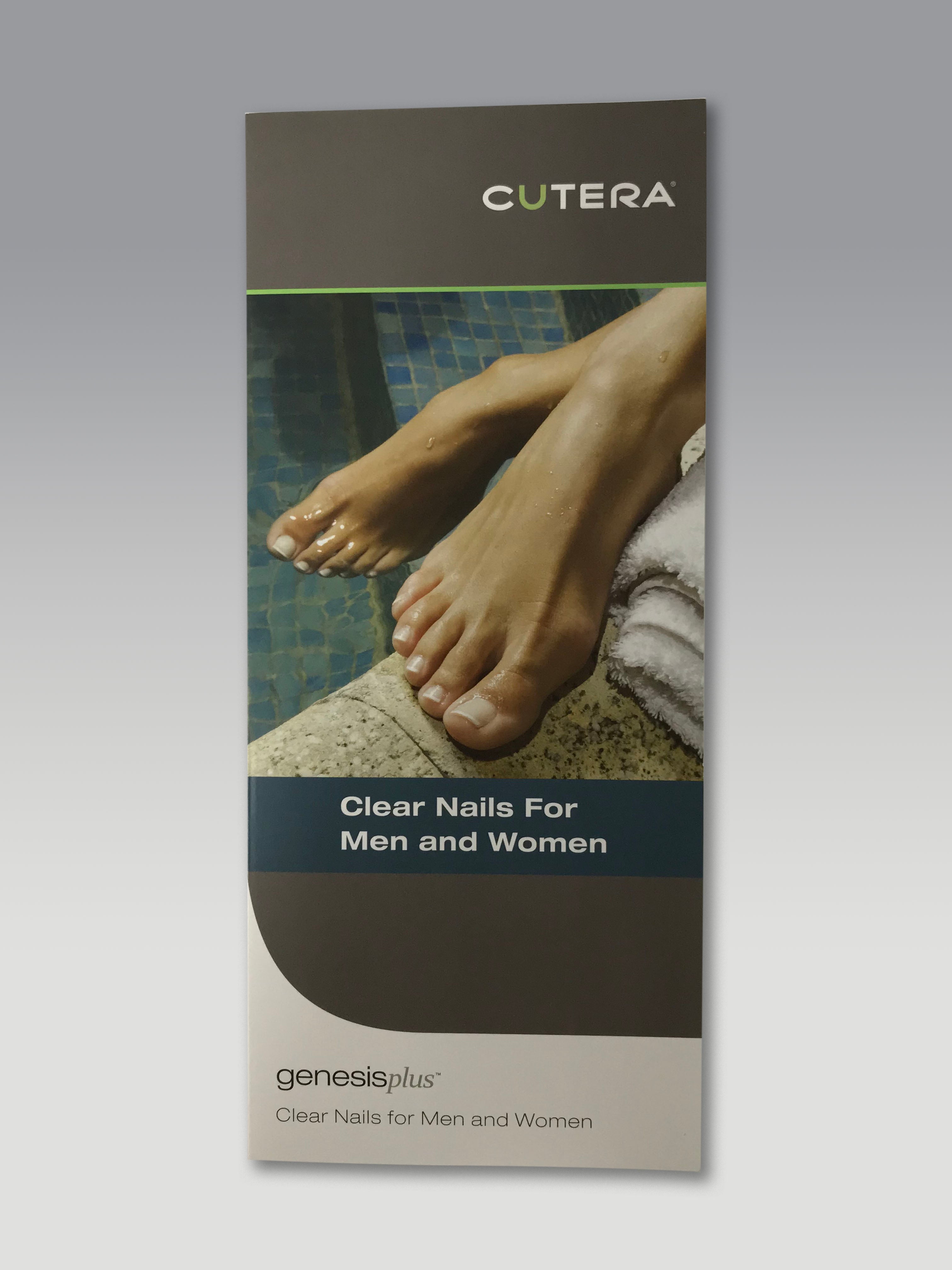 Cutera Genesis Plus Nd YAG GenesisPlus Nail Fungus Treatment Patient Brochures